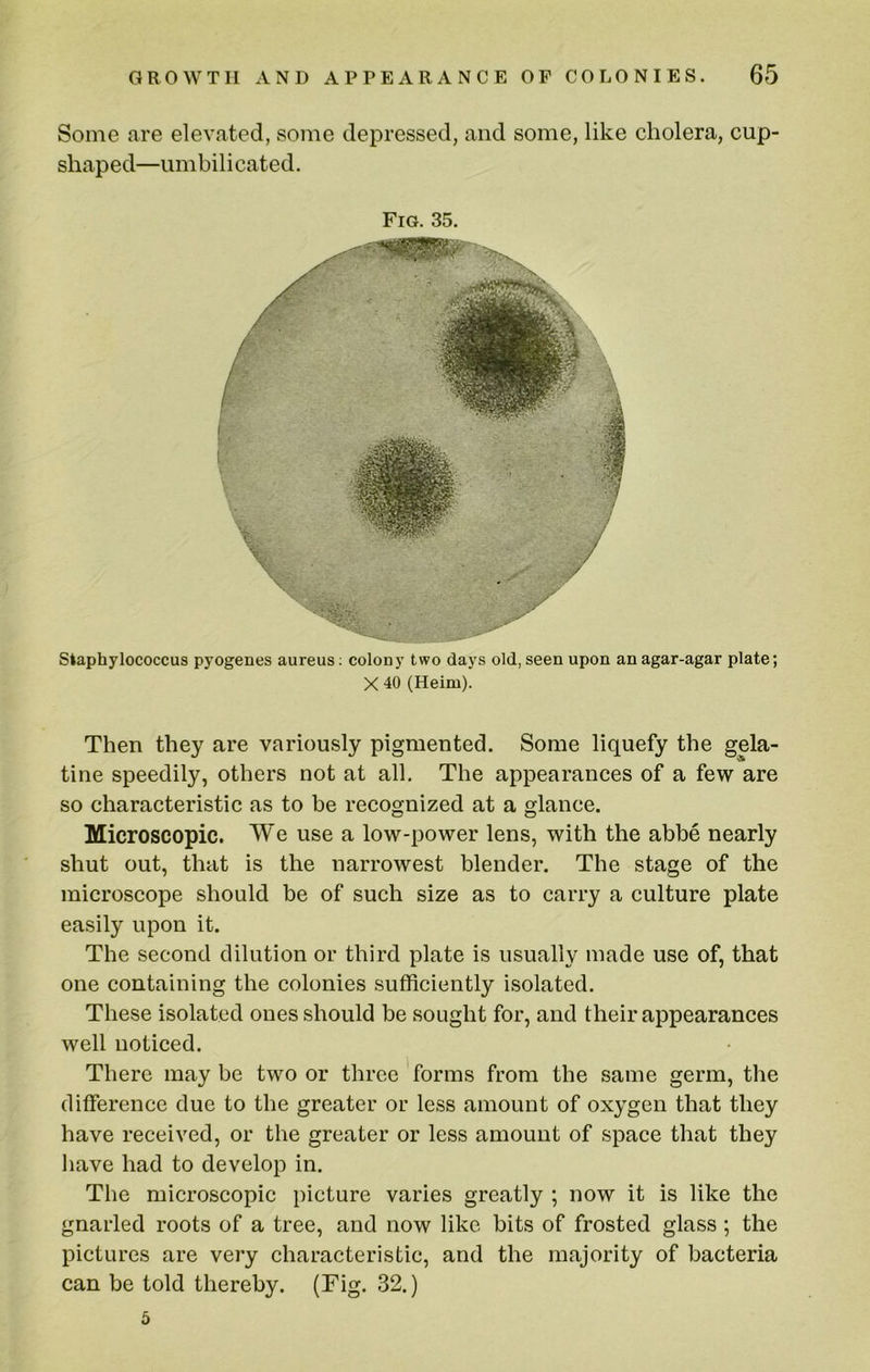 Some are elevated, some depressed, and some, like cholera, cup- shaped—umbilicated. Fig. 35. Staphylococcus pyogeues aureus; colony two days old, seen upon an agar-agar plate; X 40 (Heim). Then they are variously pigmented. Some liquefy the gela- tine speedily, others not at all. The appearances of a few are so characteristic as to be recognized at a glance. Microscopic. We use a low-power lens, with the abbe nearly shut out, that is the narrowest blender. The stage of the microscope should be of such size as to carry a culture plate easily upon it. The second dilution or third plate is usually made use of, that one containing the colonies sufficiently isolated. These isolated ones should be sought for, and their appearances well noticed. There maybe two or three forms from the same germ, the difference due to the greater or less amount of oxygen that they have received, or the greater or less amount of space that they have had to develop in. The microscopic picture varies greatly ; now it is like the gnarled roots of a tree, and now like bits of frosted glass ; the pictures are very characteristic, and the majority of bacteria can be told thereby. (Fig. 32.) 5