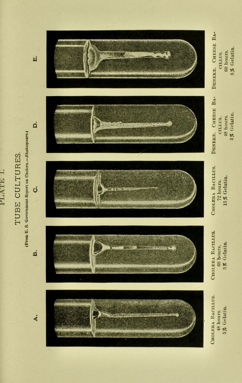 Cholera Bacillus. Cholera Bacillus. Cholera Bacillus. Deneke. Cheese B.\- Deneke. Cheese Ba 48 hours. 60 hours. 72 hours. cillus. cillus. 5^0 Gelatin. 5% Gelatin. 15^ Gelatin. 48 hours, 60 hours. 5% Gelatin. 5% Gelatin.
