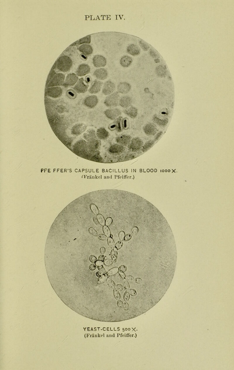 YEAST-CELLS 500X. Fl'E PEER’S CAPSULE BACILLUS IN BLOOD 1000 X ■<’r ■