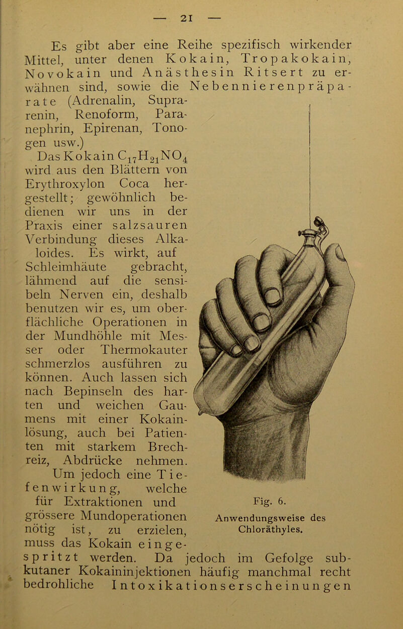 > Es gibt aber eine Reihe spezifisch wirkender Mittel, unter denen Kokain, Tropakokain, Novokain und Anästhesin Ritsert zu er- wähnen sind, sowie die N e b e n n i e r e n p r ä p a- rate (Adrenalin, Supra- renin, Renoform, Para- nephrin, Epirenan, Tono- gen usw.) Das Kokain wird aus den Blättern von Erythroxylon Coca her- gestellt ; gewöhnlich be- dienen wir uns in der Praxis einer salzsauren Verbindung dieses Alka- loides. Es wirkt, auf Schleimhäute gebracht, lähmend auf die sensi- beln Nerven ein, deshalb benutzen wir es, um ober- flächliche Operationen in der Mundhöhle mit Mes- ser oder Thermokauter schmerzlos ausführen zu können. Auch lassen sich nach Bepinseln des har- ten und weichen Gau- mens mit einer Kokain- lösung, auch bei Patien- ten mit starkem Brech- reiz, Abdrücke nehmen. Um jedoch eine Tie- fenwirkung, welche für Extraktionen und Fig. 6. grössere Mundoperationen Anwendungsweise des nötig ist, zu erzielen, Chloräthyles. muss das Kokain einge- spritzt werden. Da jedoch im Gefolge sub- kutaner Kokaininjektionen häufig manchmal recht bedrohliche Intoxikationserscheinungen