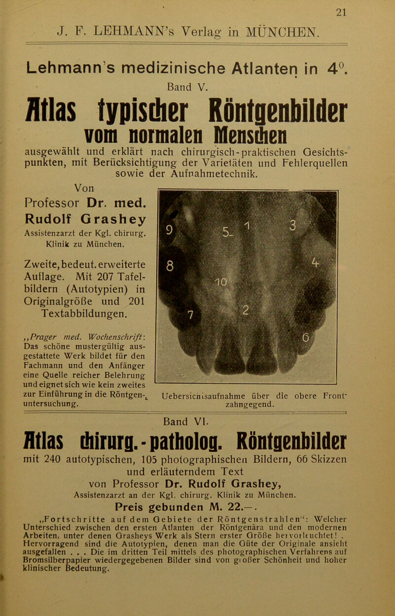 J. F. LEHMANN’s Verlag in MÜNCHEN. Lehmann’s medizinische Atlanten in 4°. Band V. Atlas typisdier Röntgenliilder vom normalen Mensdien ausgewählt und erklärt nach chirurgisch-praktischen Gesichts- punkten, mit Berücksichtigung der Varietäten und Fehlerquellen sowie der Aufnahmetechnik. Von Professor Dr. med. Rudolf Grashey Assistenzarzt der Kgl. Chirurg. Klinik zu München. Zweite, bedeut, erweiterte Auflage. Mit 207 Tafel- bildern (Autotypien) in Originalgröße und 201 T extabbildungen. ,,Prager med. Wochenschrift'. Das schöne mustergültig aus- gestattete Werk bildet für den Fachmann und den Anfänger eine Quelle reicher Belehrung und eignet sich wie kein zweites zur Einführung in die Röntgen-^ Uebersichisaufnahme über die obere Front' Untersuchung. zahngegend. ¥and VI. ’ Atlas diirurg.-patholog. Röntgenbilder mit 240 autotypischen, 105 photographischen Bildern, 66 Skizzen und erläuterndem Text von Professor Dr. Rudolf Grashey, Assistenzarzt an der Kgl. Chirurg. Klinik zu München. Preis gebunden M. 22.— . „Fortschritte auf dem Gebiete der Röntgenstrahlen“; Welcher Unterschied zwischen den ersten Atlanten der Röntgenära und den modernen Arbeiten, unter denen Grasheys Werk als Stern erster Größe hervorUuchtet! . Hervorragend sind die Autotypien, denen man die Güte der Originale ansieht ausgefallen . . . Die im dritten Teil mittels des photographischen Verfahrensauf Bromsilberpapier wiedergegebenen Bilder sind von gioßer Schönheit und hoher klinischer Bedeutung.