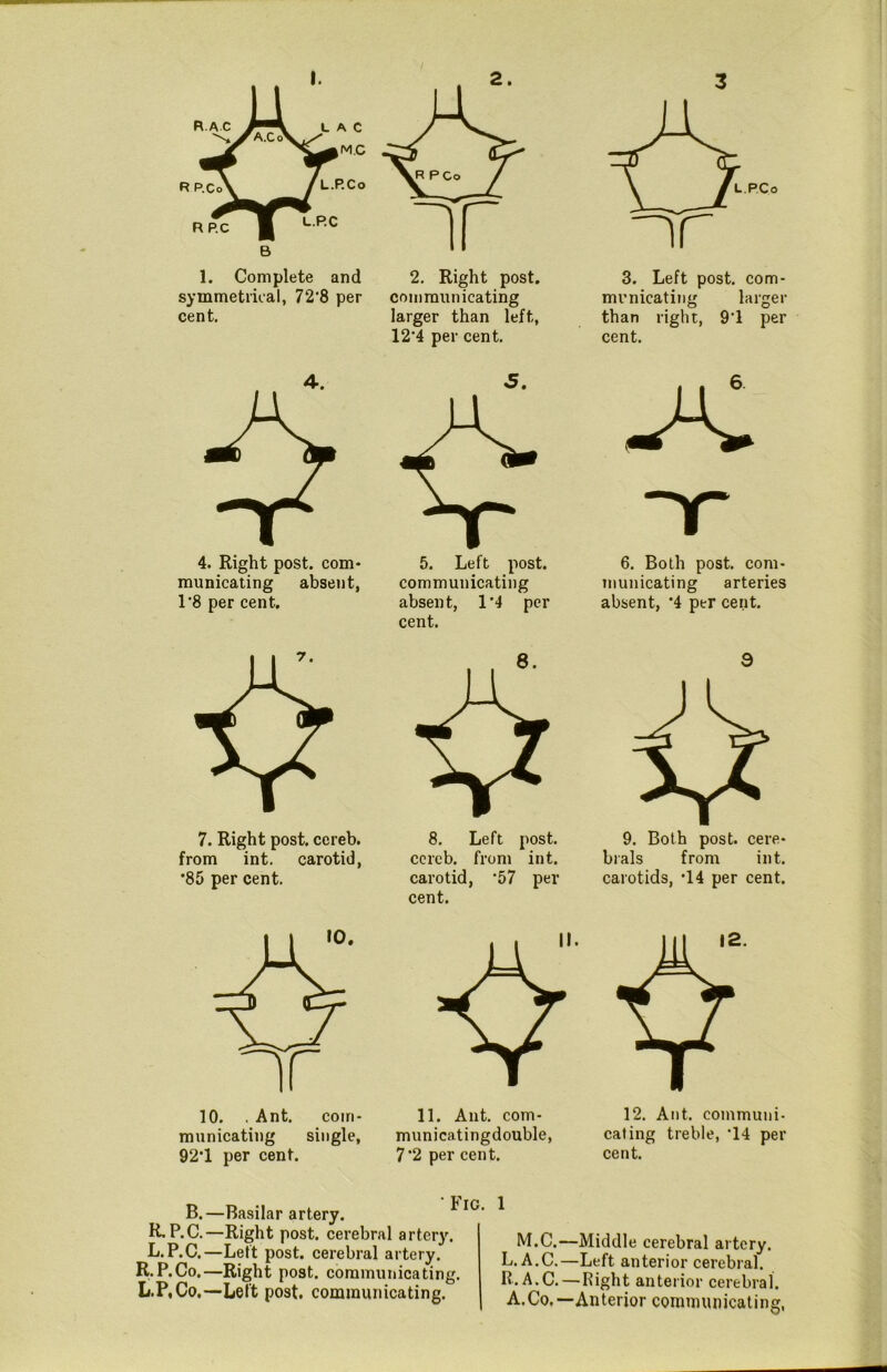 R.A c 1. Complete and 2. Right post, symmetrical, 72‘8 per communicating cent. larger than left, 12'4 per cent. 4. 4. Right post, com- municating absent, 1‘8 per cent. 7. Right post, cereb. from int. carotid, ’85 per cent. 10. . Ant. com- municating single, 921 per cent. 5. 5. Left post, communicating absent, 11 per cent. 8. Left post, ccrcb. from int. carotid, 57 per cent. 11. Ant. com- municatingdouble, 7*2 per cent. 3. Left post, com- municating larger than right, 91 per cent. 6. Both post, com- municating arteries absent, ‘4 per cent. 3 brals from int. carotids, 14 per cent. 12. Ant. communi- cating treble, 14 per cent. Fig. 1 B.—Basilar artery. B.P.C.—Right post, cerebral artery. L.P.C.—Left post, cerebral artery. R.P.Co.—Right post, communicating. L.P,Co.—Left post, communicating. M.C.—Middle cerebral artery. L. A.C.—Left anterior cerebral. R. A.C.—Right anterior cerebral. A.Co.— Anterior communicating,