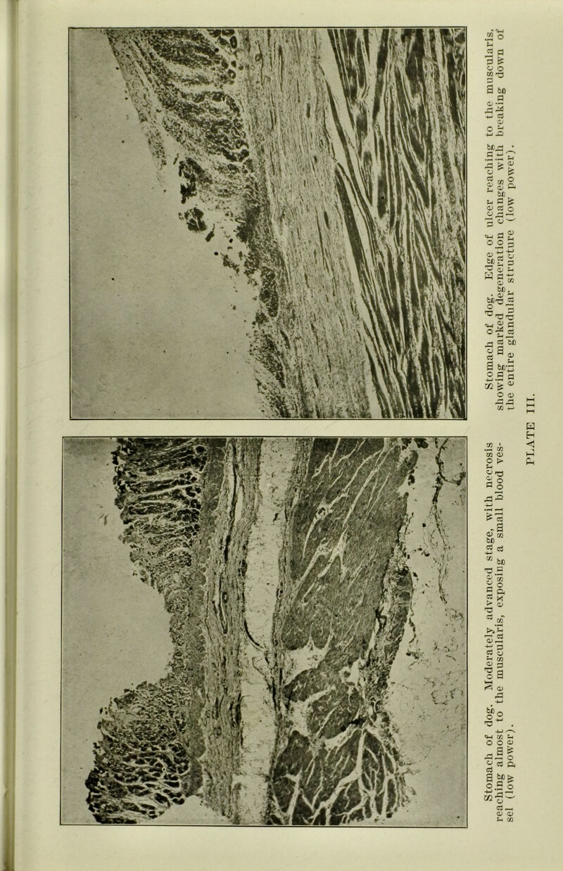 L Stomach of dog. Moderately advanced stage, with necrosis Stomach of dog. Edge of ulcer reaching to the muscularis, reaching almost to the muscularis, exposing a small blood ves- showing marked degeneration changes with breaking down of sel (low power). the entire glandular structure (low power).