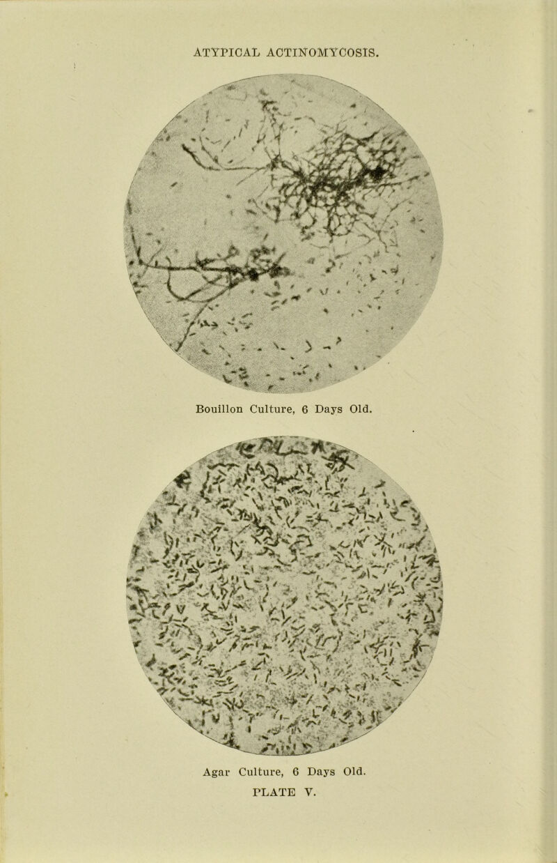 ATYriCAL ACTINOMYCOSIS Bouillon Culture, 6 Days Old. '0*. / ^ % * » . - Agar Culture, 6 Days Old. TLATE V.