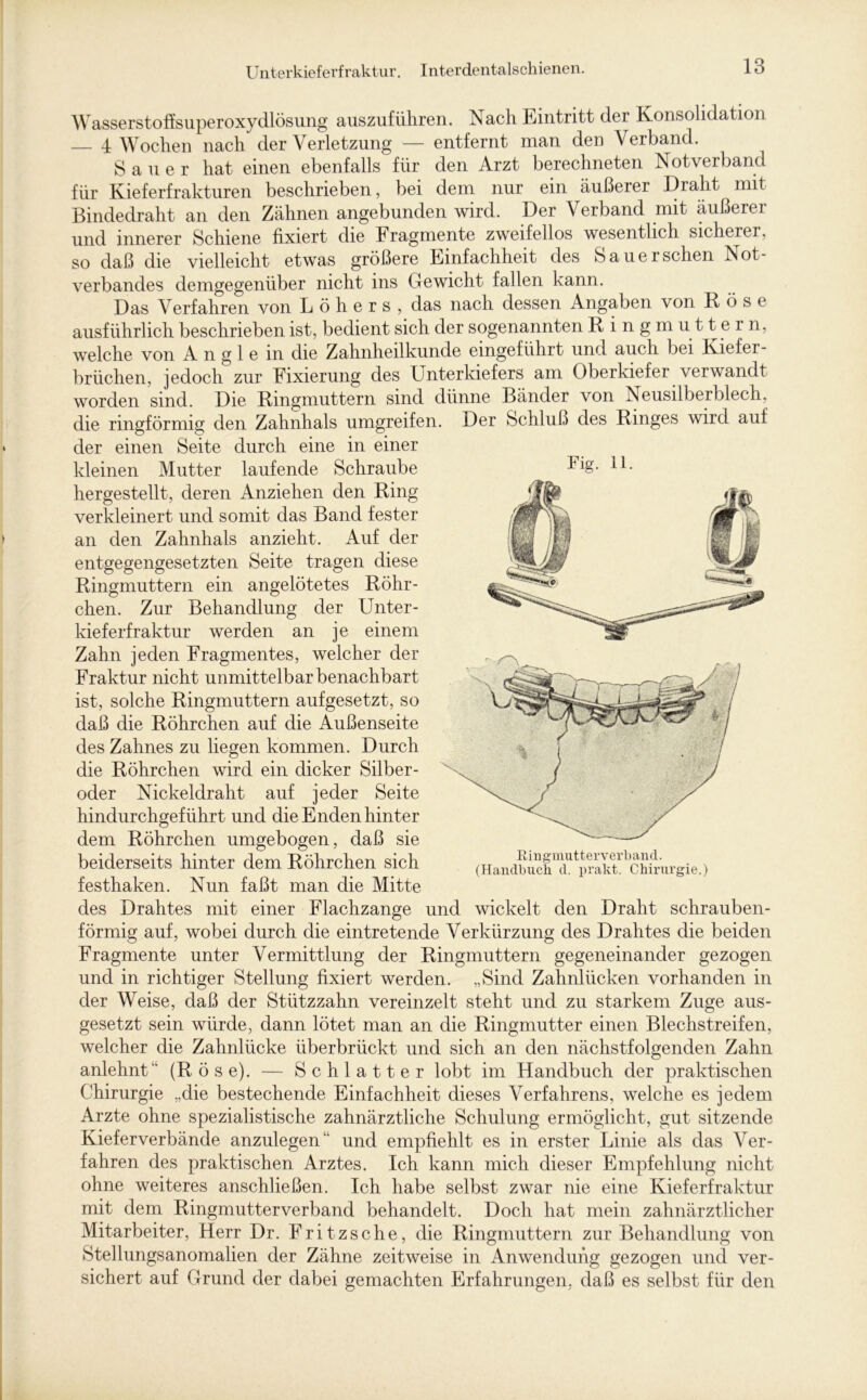 Wasserstoffsuperoxydlösung auszufiihren. Nach Eintritt der Konsolidation — 4 Wochen nach der Verletzung — entfernt nran den Verband. Sauer hat einen ebenfalls für den Arzt berechneten Not verband für Kieferfrakturen beschrieben, bei dem nur ein äußerer Draht mit Bindedraht an den Zähnen angebunden wird. Der Verband mit äußeret und innerer Schiene fixiert die Fragmente zweifellos wesentlich sicherer, so daß die vielleicht etwas größere Einfachheit des Sauer sehen Not- verbandes demgegenüber nicht ins Gewicht fallen kann. Das Verfahren von Löhers, das nach dessen Angaben von Röse ausführlich beschrieben ist, bedient sich der sogenannten K ingmuttern, welche von Angle in die Zahnheilkunde eingeführt und auch bei Kiefer- brüchen, jedoch zur Fixierung des Unterkiefers am Oberkiefer verwandt worden sind. Die Rmgmuttern sind dünne Bänder von Neusilberblech, die ringförmig den Zahnhals umgreifen. Der Schluß des Ringes wird auf der einen Seite durch eine in einer kleinen Mutter laufende Schraube H. hergestellt, deren Anziehen den Ring verkleinert und somit das Band fester an den Zahnhals anzieht. Auf der entgegengesetzten Seite tragen diese Ringmuttern ein angelötetes Röhr- chen. Zur Behandlung der Unter- kieferfraktur werden an je einem Zahn jeden Fragmentes, welcher der Fraktur nicht unmittelbar benachbart ist, solche Ringmuttern aufgesetzt, so daß die Röhrchen auf die Außenseite des Zahnes zu liegen kommen. Durch die Röhrchen wird ein dicker Silber- oder Nickeldraht auf jeder Seite hindurchgeführt und die Enden hinter dem Röhrchen umgebogen, daß sie beiderseits hinter dem Röhrchen sich festhaken. Nun faßt man die Mitte des Drahtes mit einer Flachzange und wickelt den Draht schrauben- förmig auf, wobei durch die eintretende Verkürzung des Drahtes die beiden Fragmente unter Vermittlung der Ringmuttern gegeneinander gezogen und in richtiger Stellung fixiert werden. „Sind Zahnlücken vorhanden in der Weise, daß der Stützzahn vereinzelt steht und zu starkem Zuge aus- gesetzt sein würde, dann lötet man an die Ringmutter einen Blechstreifen, welcher die Zahnlücke überbrückt und sich an den nächstfolgenden Zahn anlehnt (Röse). — Schiatter lobt im Handbuch der praktischen Chirurgie „die bestechende Einfachheit dieses Verfahrens, welche es jedem Arzte ohne spezialistische zahnärztliche Schulung ermöglicht, gut sitzende Kieferverbände anzulegen und empfiehlt es in erster Linie als das Ver- fahren des praktischen Arztes. Ich kann mich dieser Empfehlung nicht ohne weiteres anschließen. Ich habe selbst zwar nie eine Kieferfraktur mit dem Ringmutter verband behandelt. Doch hat mein zahnärztlicher Mitarbeiter, Herr Dr. Fritzsche, die Ringmuttern zur Behandlung von Stellungsanomalien der Zähne zeitweise in Anwendung gezogen und ver- sichert auf Grund der dabei gemachten Erfahrungen, daß es selbst für den Ringmutterverband. (Handbuch d. prakt. Chirurgie.)