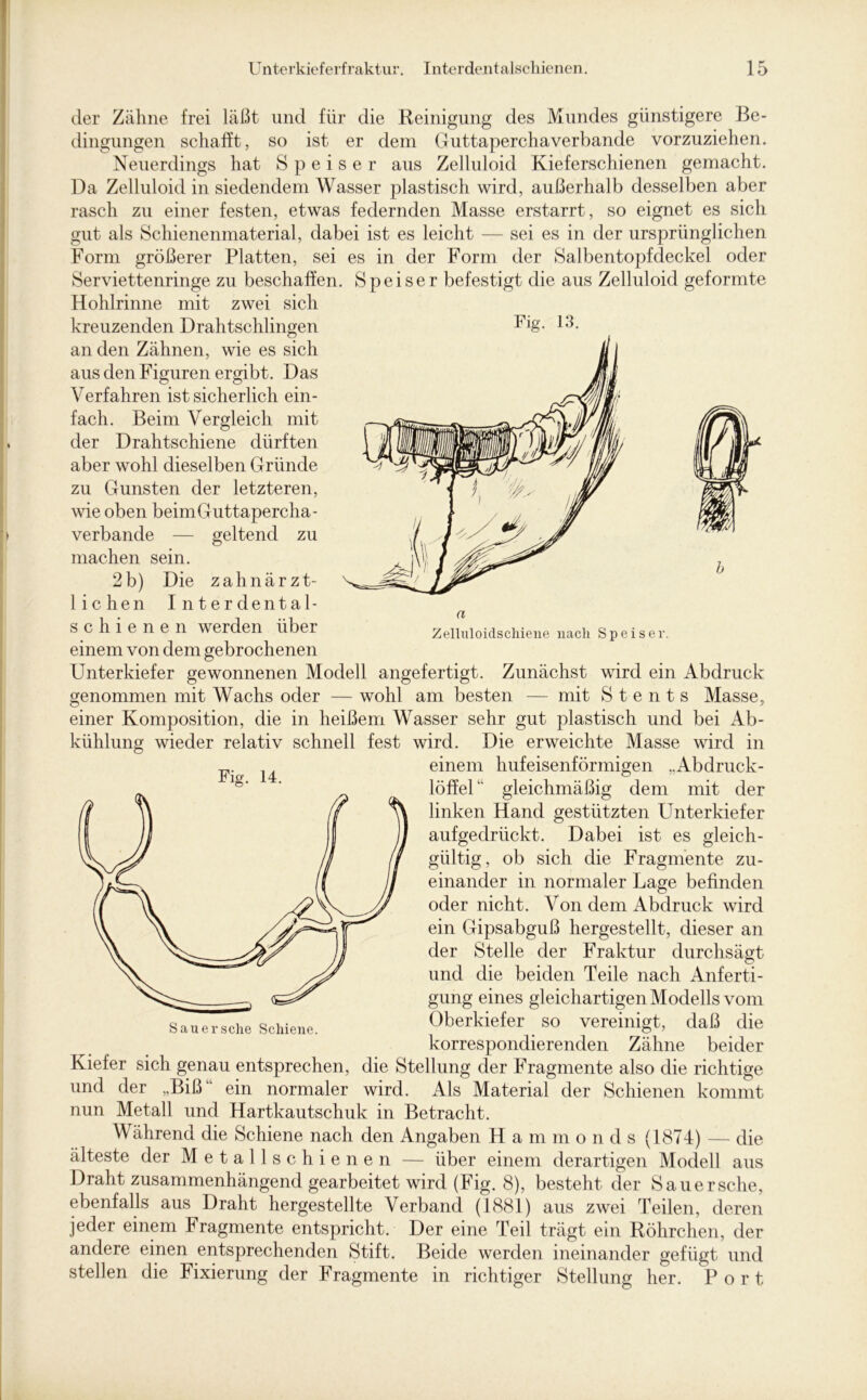 der Zähne frei läßt und für die Reinigung des Mundes günstigere Be- dingungen schafft, so ist er dem Guttaperchaverbande vorzuziehen. Neuerdings hat Speiser aus Zelluloid Kieferschienen gemacht. Da Zelluloid in siedendem Wasser plastisch wird, außerhalb desselben aber rasch zu einer festen, etwas federnden Masse erstarrt, so eignet es sich gut als Schienenmaterial, dabei ist es leicht — sei es in der ursprünglichen Form größerer Platten, sei es in der Form der Salbentopfdeckel oder Serviettenringe zu beschaffen. Speiser befestigt die aus Zelluloid geformte Hohlrinne mit zwei sich kreuzenden Drahtschlingen an den Zähnen, wie es sich aus den Figuren ergibt. Das Verfahren ist sicherlich ein- fach. Beim Vergleich mit der Drahtschiene dürften aber wohl dieselben Gründe zu Gunsten der letzteren, wie oben beim Guttapercha- verbande — geltend zu machen sein. 2b) Die zahnärzt- lichen Interdental- schienen werden Übei Zelluloidschiene nach Speiser, einem von dem gebrochenen Unterkiefer gewonnenen Modell angefertigt. Zunächst wird ein Abdruck genommen mit Wachs oder — wohl am besten — mit S t e n t s Masse, einer Komposition, die in heißem Wasser sehr gut plastisch und bei Ab- kühlung wieder relativ schnell fest wird. Die erweichte Masse wird in einem hufeisenförmigen „Abdruck- löffel“ gleichmäßig dem mit der linken Hand gestützten Unterkiefer aufgedrückt. Dabei ist es gleich- gültig, ob sich die Fragmente zu- einander in normaler Lage befinden oder nicht. Von dem Abdruck wird ein Gipsabguß hergestellt, dieser an der Stelle der Fraktur durchsägt und die beiden Teile nach Anferti- gung eines gleichartigen Modells vom Oberkiefer so vereinigt, daß die korrespondierenden Zähne beider Kiefer sich genau entsprechen, die Stellung der Fragmente also die richtige und der „Biß“ ein normaler wird. Als Material der Schienen kommt nun Metall und Hartkautschuk in Betracht. Während die Schiene nach den Angaben H a m m o n d s (1874) — die älteste der Metallschienen — über einem derartigen Modell aus Draht zusammenhängend gearbeitet wird (Fig. 8), besteht der Sauersche, ebenfalls aus Draht hergestellte Verband (1881) aus zwei Teilen, deren jeder einem Fragmente entspricht. Der eine Teil trägt ein Röhrchen, der andere einen entsprechenden Stift. Beide werden ineinander gefügt und stellen die Fixierung der Fragmente in richtiger Stellung her. P o r t Fig. 14.