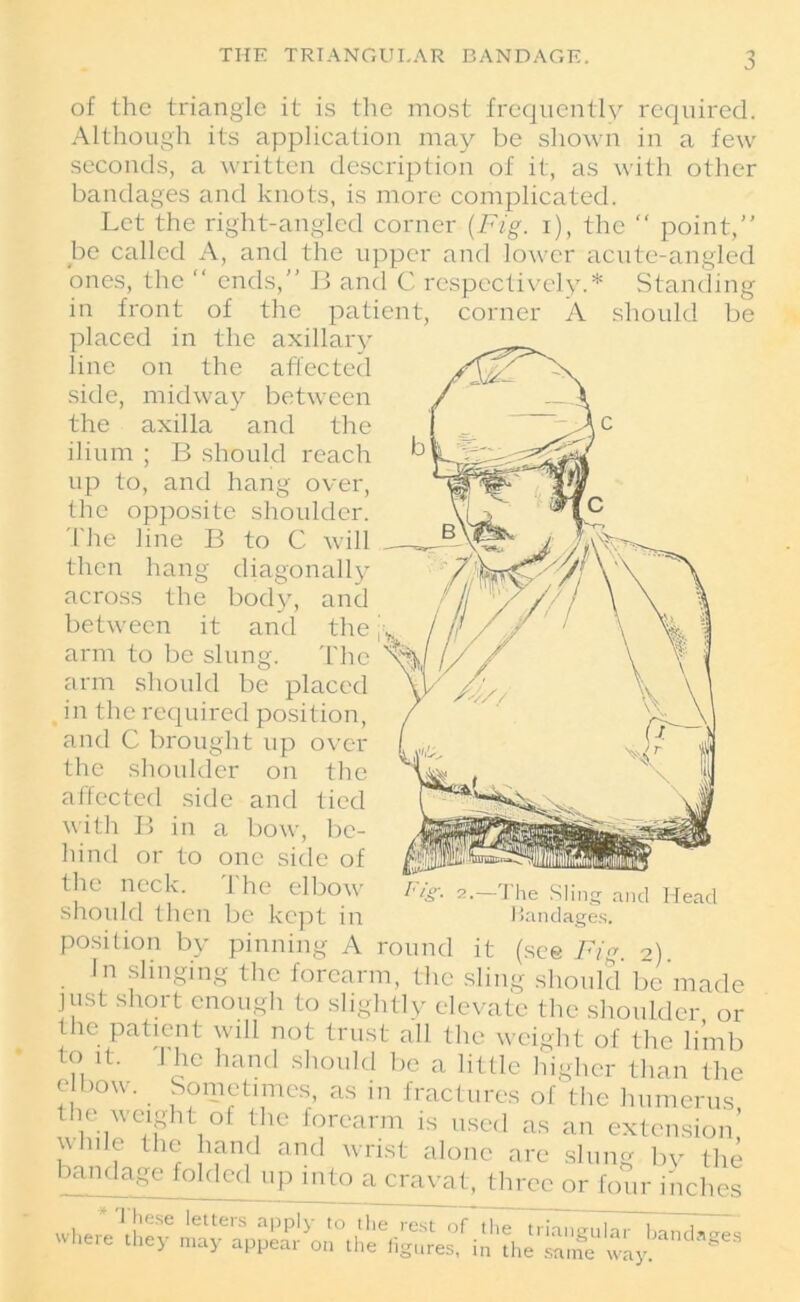 THE TRIANGULAR BANDAGE. of the triangle it is the most frequently required. Although its applieation may be shown in a few seconds, a written description of it, as with other bandages and knots, is more complicated. Let the right-angled corner (Fig. i), the “ point, be called A, and the upper and lower acute-angled ones, the “ ends,” B and C respectively.* Standing in front of the patient, corner A should be placed in the axillary line on the affected side, midway between the axilla and the ilium ; B should reach up to, and hang over, the opposite shoulder. The line B to C will then hang diagonally across the body, and between it and the arm to be slum The arm should be placed in the required position, and C brought up over the shoulder on the affected side and tied with B in a bow, be- hind or to one side of the neck. The elbow should then be kept in The Sling and Head Bandages. position by pinning A round it (see Fig. 2). In slinging the forearm, the sling should be made just short enough to slightly elevate the shoulder or the patient will not trust all the weight of the limb lt- 1 llc hancl should be a little higher than the elbow. Sometimes as in fractures of'the humerus V10 f°rcarm is used as an extension, the hand and wrist alone are slung by the bandage folded up into a cravat, three or four inches