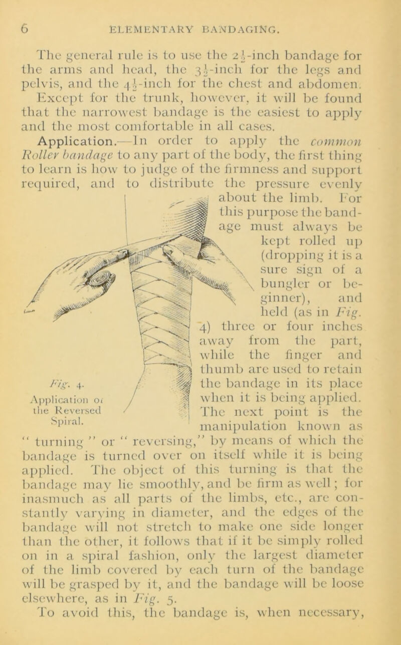 general rule is to use the 21 -inch bandage for The the arms and head, the 3l-inc.l1 for the legs and pelvis, and the 41-inch for the chest and abdomen. Except for the trunk, however, it will be found that the narrowest bandage is the easiest to apply and the most comfortable in all cases. Application.—In order to apply the common Roller bandage to any part of the body, the first thing to learn is how to judge of the firmness and support required, and to distribute the pressure evenly about the limb. For this purpose the band- age must always be kept rolled up (dropping it is a sure sign of a bungler or be- ginner), and held (as in Fig. three or four inches away from the part, while the finger and thumb arc used to retain the bandage in its place when it is being applied. The next point is the manipulation known as ” by means of which the being the Fig- 4- Application o; the Reversed Spiral. turning or bandage reversing, is turned over on itself while it is applied. The object of this turning is that bandage may lie smoothly, anti be firm as well; for inasmuch as all parts of the limbs, etc., are con- stantly varying in diameter, and the edges of the bandage will not stretch to make one side longer than the other, it follows that if it be simply rolled on in a spiral fashion, only the largest diameter of the limb covered by each turn of the bandage will be grasped by it, and the bandage will be loose elsewhere, as in Fig. 5. To avoid this, the bandage is, when necessary,