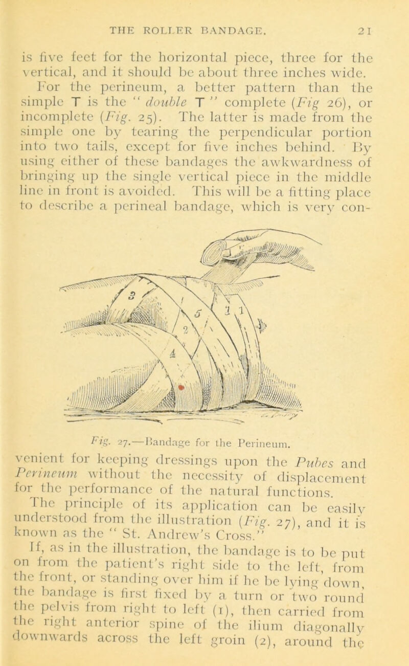 is five feet for the horizontal piece, three for the vertical, and it should be about three inches wide. For the perineum, a better pattern than the simple T is the “ double T  complete (Fig 26), or incomplete (Fig. 25). The latter is made from the simple one by tearing the perpendicular portion into two tails, except for five inches behind. By using either of these bandages the awkwardness of bringing up the single vertical piece in the middle line in front is avoided. This will be a fitting place to describe a perineal bandage, which is very con- venient for keeping dressings upon the Pubes and Perineum without the necessity of displacement for the performance of the natural functions. The principle of its application can be easily understood from the illustration (Fie. 27) and it is known as the “ St. Andrew’s Cross.’’ If, as in the illustration, the bandage is to be put on from the patient’s right side to the left, from the front, or standing over him if he be lying down the bandage is first fixed by a turn or two round the pelvis from right to left (1), then carried from the right anterior spine of the ilium diagonally downwards across the left groin (2), around the