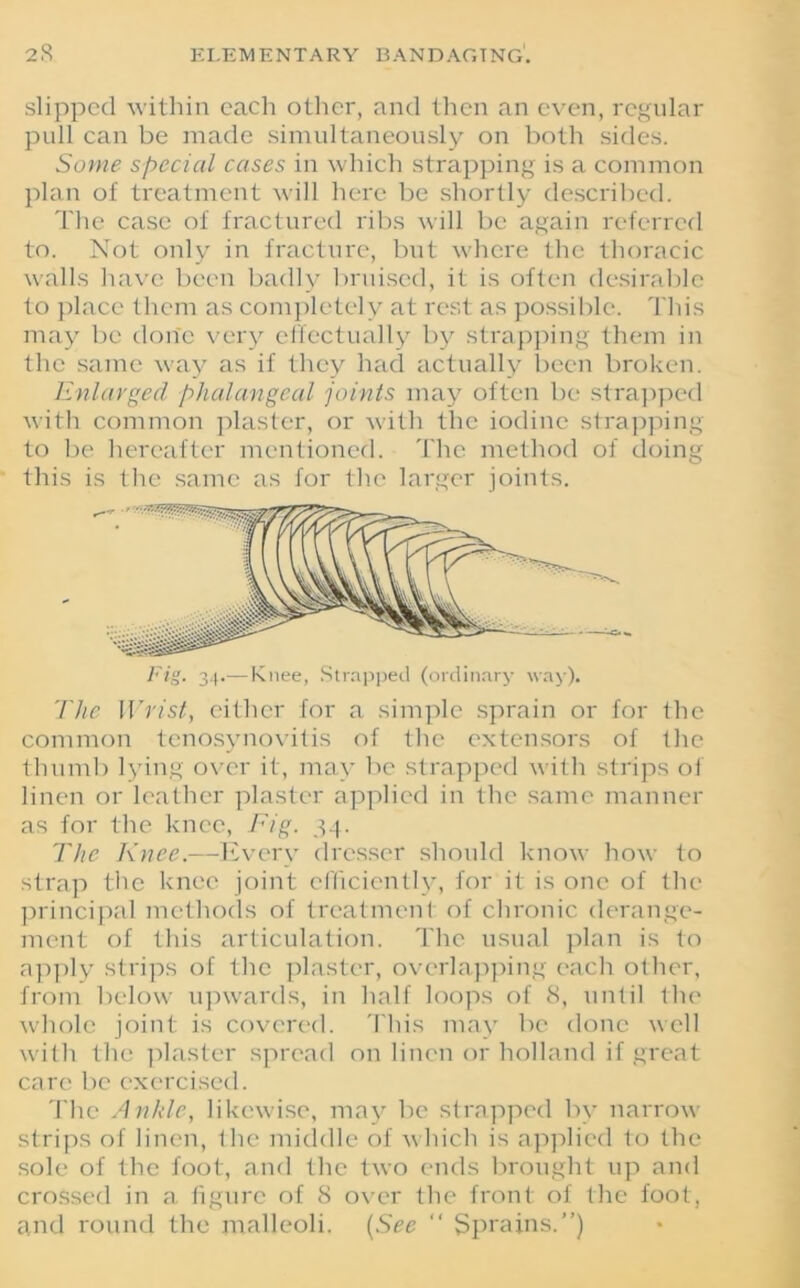 slipped within each other, and then an even, regular pull can be made simultaneously on both sides. Some special cases in which strapping is a common plan of treatment will here be shortly described. The case of fractured ribs will be again referred to. Not only in fracture, but where the thoracic walls have been badly bruised, it is often desirable to place them as completely at rest as possible. This may be done very effectually by strapping them in the same way as if they had actually been broken. Enlarged phalangeal joints may often be strapped with common plaster, or with the iodine strapping to be hereafter mentioned. The method of doing this is the same as for the larger joints. Fig. 34.— Knee, Strapped (ordinary way). The Wrist, either for a simple sprain or for the common tenosynovitis of the extensors of the thumb lying over it, may be strapped with strips of linen or leather plaster applied in the same manner as for the knee, Fig. 34. The Knee.—Every dresser should know how to strap the knee joint efficiently, for it is one of the principal methods of treatment of chronic derange- ment of this articulation. The usual plan is to apply strips of the plaster, overlapping each other, from below upwards, in half loops of 8, until the whole joint is covered. This may be clone well with the plaster spread on linen or holland if great care be exercised. The Ankle, likewise, may be strapped by narrow strips of linen, the middle of which is applied to the sole of the foot, and the two ends brought up and crossed in a figure of 8 over the front of the foot, and round the malleoli. (See “ Sprains.”)