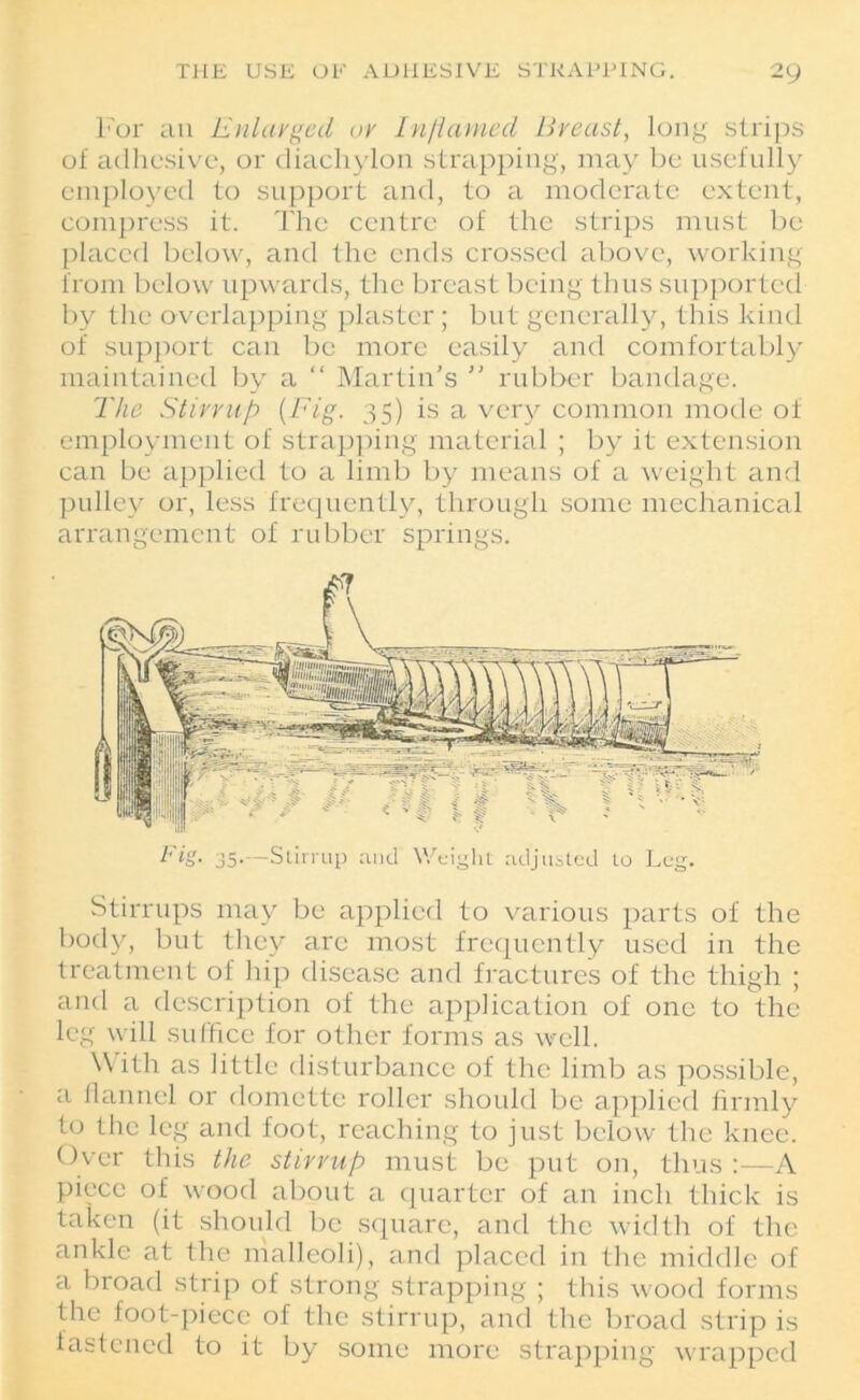 For au Enlarged or Inflamed Breast, long strips of adhesive, or diachylon strapping, may be usefully employed to support and, to a moderate extent, compress it. The centre of the strips must be placed below, and the ends crossed above, working from below upwards, the breast being thus supported by the overlapping plaster; but generally, this kind of support can be more easily and comfortably maintained by a “ Martin’s ” rubber bandage. The Stirrup {Fig. 35) is a very common mode of employment of strapping material ; by it extension can be applied to a limb by means of a weight and pulley or, less frequently, through some mechanical arrangement of rubber springs. Fig. 35. -Stirrup and Weight adjusted to Leg. Stirrups may be applied to various parts of the body, but they arc most frequently used in the treatment of hip disease and fractures of the thigh ; and a description of the application of one to the leg will suffice for other forms as well. With as little disturbance of the limb as possible, a flannel or domette roller should be applied firmly to the leg and foot, reaching to just below the knee. Over this the stirrup must be put on, thus :—A piece of wood about a quarter of an inch thick is taken (it should be square, and the width of the ankle at the malleoli), and placed in the middle of a broad strip of strong strapping ; this wood forms the foot-piece of the stirrup, and the broad strip is fastened to it by some more strapping wrapped