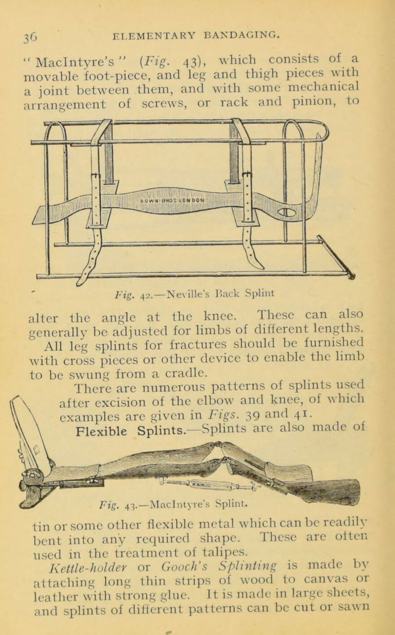 “ MacIntyre's (jFig. 43), which consists of a movable foot-piece, and leg and thigh pieces with a joint between them, and with some mechanical arrangement of screws, or rack and pinion, to alter the angle at the knee. These can also generally be adjusted for limbs of different lengths. All leg splints for fractures should be furnished with cross pieces or other device to enable the limb to be swung from a cradle. There are numerous patterns of splints used tin or some other flexible metal which can be readily bent into any required shape. Ihese are often used in the treatment of talipes. Kettle-holder or Gooch’s Splinting is made by attaching long thin strips of wood to canvas or leather with strong glue. It is made in large sheets, and splints of different patterns can be cut or sawn