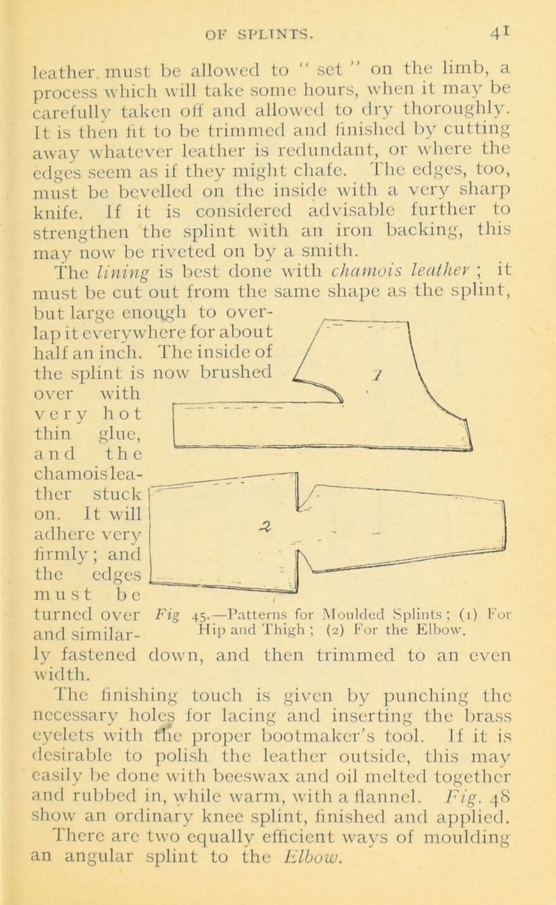 leather must be allowed to “ set ” on the limb, a process which will take some hours, when it may be carefully taken off and allowed to dry thoroughly. It is then fit to be trimmed and finished by cutting away whatever leather is redundant, or where the edges seem as if they might chafe. The edges, too, must be bevelled on the inside with a very sharp knife. If it is considered advisable further to strengthen the splint with an iron backing, this may now be riveted on by a smith. The lining is best done with chamois leather ; it must be cut out from the same shape as the splint, but large enough to over- lap it everywhere for about half an inch. The inside of the splint is now brushed over with very hot thin glue, and the chamois lea- ther stuck on. It will adhere very firmly; and the edges must be turned over Fig 45.—Patterns for Moulded Splints; (1) Pol- and similar- HiP and Thigh ; (2) For the Elbow. ly fastened down, and then trimmed to an even width. The finishing touch is given by punching the necessary holes for lacing and inserting the brass eyelets with me proper bootmaker’s tool. If it is desirable to polish the leather outside, this may easily be done with beeswax and oil melted together and rubbed in, while warm, with a flannel. Fig. 48 show an ordinary knee splint, finished and applied. There arc two equally efficient ways of moulding an angular splint to the Elbow.