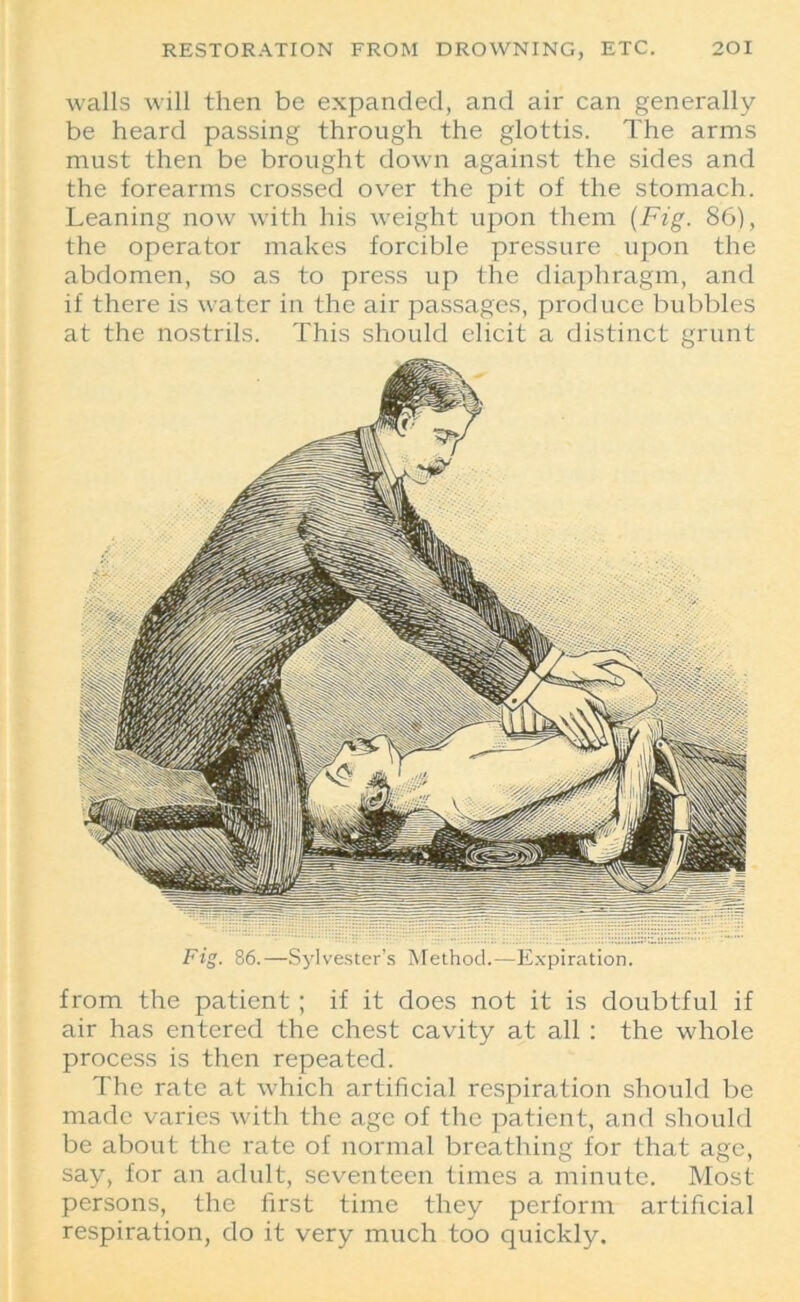 walls will then be expanded, and air can generally be heard passing through the glottis. The arms must then be brought down against the sides and the forearms crossed over the pit of the stomach. Leaning now with his weight upon them (Fig. 86), the operator makes forcible pressure upon the abdomen, so as to press up the diaphragm, and if there is water in the air passages, produce bubbles at the nostrils. This should elicit a distinct grunt Fig. 86.—Sylvester’s Method.—Expiration. from the patient; if it does not it is doubtful if air has entered the chest cavity at all : the whole process is then repeated. The rate at which artificial respiration should be made varies with the age of the patient, and should be about the rate of normal breathing for that age, say, for an adult, seventeen times a minute. Most persons, the first time they perform artificial respiration, do it very much too quickly.