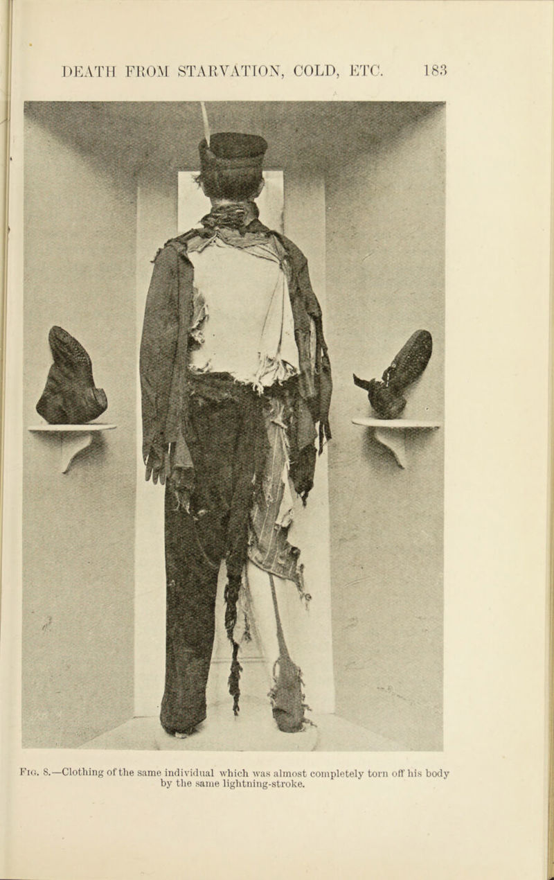 Fig. S.—Clothing of the same individual which was almost completely torn off his body by the same lightning-stroke.