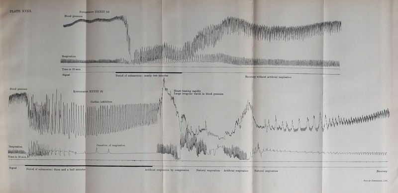 Expedient XXXIII (a) Blood pressure Period of submersion: three and a half minutes Artificial respiijation by compression Natural respiration ■ Artificial respiration Natural respiration Becovory