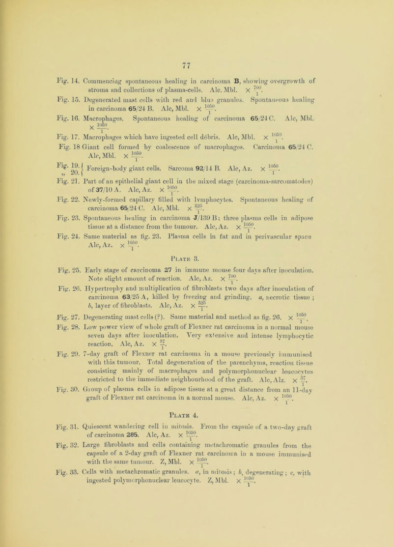 Fig. 14. Commencing spontaneous healing in carcinoma B, showing overgrowth of stroma and collections of plasma-cells. Ale. Mbl. X -,)0. Fig. 15. Degenerated mast cells with red and blue granules. Spontaneous healing in carcinoma 65/24 B. Ale, Mbl. X 16. Macrophages. Spontaneous healing of carcinoma 65/24 C. Ale, Mbl. v 1050 1 ‘ 17. Macrophages which have ingested cell debris. Ale, Mbl. x Fig. 18 Giant cell formed by coalescence of macrophages. Carcinoma 65/24 C. Fig. Fig. Ale, Mbl. x 1050 Fig. Fig. Fig. Fig. Fig. 20.} Forei eign-body giant cells. Sarcoma 92/14 B. Ale, Az. x 1050 21. Part of an epithelial giant cell in the mixed stage (carcinoma-sarcomatodes) of 37/10 A. Ale, Az. X1—. 22. Newly-formed capillary filled with lymphocytes. Spontaneous healing of carcinoma 65 24 C. Ale, Mbl. x -y. 23. Spontaneous healing in carcinoma J/139B: three plasma cells in adipose tissue at a distance from the tumour. Ale, Az. x —\ 24. Same material as tig. 23. Plasma cells in fat and in perivascular space Ale, Az. x'if. Plate 3. Fig. 25. Early stage of carcinoma 27 in immune mouse four days after inoculation. Note slight amount of reaction. Ale, Az. x Fig. 26. Hypertrophy and multiplication of fibroblasts two days after inoculation of carcinoma 63/25 A, killed by freezing and grinding, a, necrotic tissue ; b, layer of fibroblasts. Ale, Az. x y2. Fig. 27. Degenerating mast cells (P). Same material and method as fig. 26. x ll^°. Fig. 28. Low power view of whole graft of Flexner rat carcinoma in a normal mouse seven days after inoculation. Very extensive and intense lymphocytic reaction. Ale, Az. X y. Fig. 29. 7-day graft of Flexner r-at carcinoma in a mouse previously immunised with this tumour. Total degeneration of the parenchyma, reaction tissue consisting mainly of macrophages and polymorphonuclear leucocytes restricted to the immediate neighbourhood of the graft. Alc,Alz. X —. Fig. 30. Gioup of plasma cells in adipose tissue at a great distance from an 11-dav graft of Flexner rat carcinoma in a normal mouse. Ale, Az. x 1050. Plate 4. Fig. 31. Quiescent wandering cell in mitosis. From the capsule of a two-day graft of carcinoma 285. Ale, Az. x —5°. Fig. 32. Large fibroblasts and cells containing met achromatic granules from the capsule of a 2-day graft of Flexner rat carcinoma in a mouse immunised with the same tumour. Z, Mbl. x . Fig. 33. Cells with metachromatic granules, a, in mitosis; degenerating; c. with ingested polymorphonuclear leucocyte. Z, Mbl. x —52.