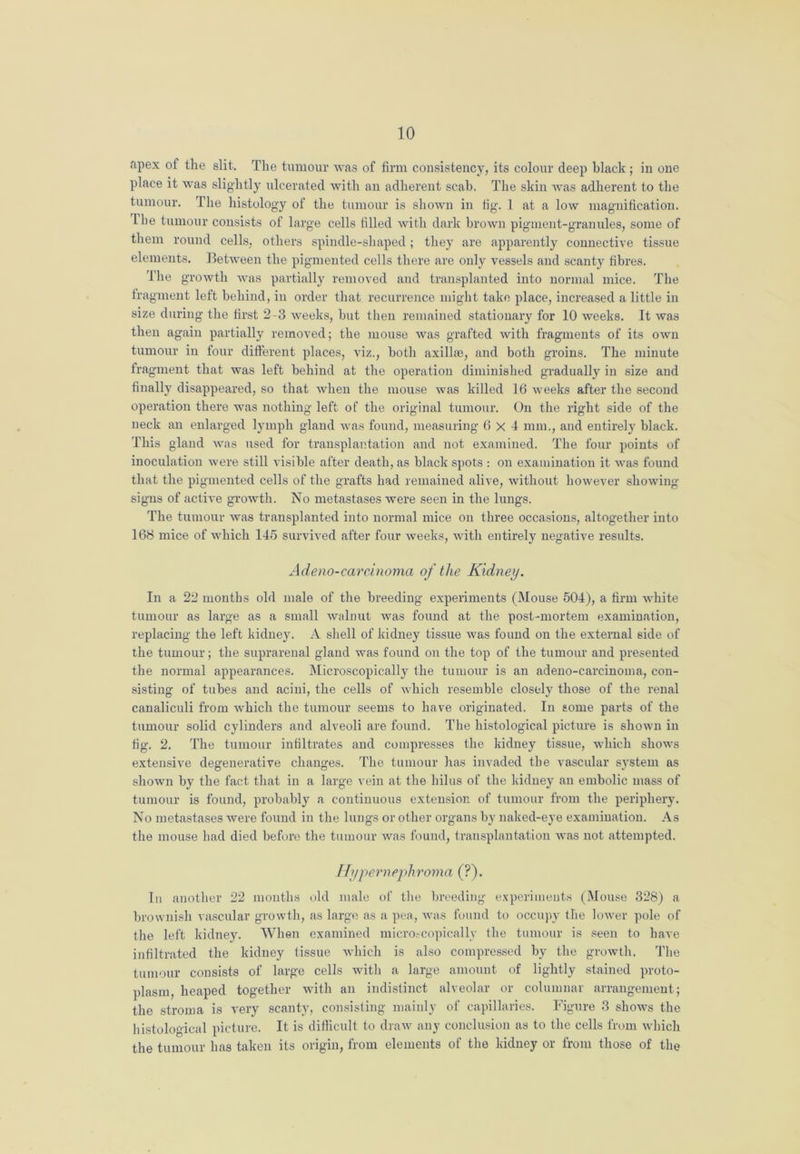 apex of the slit. The tumour was of firm consistency, its colour deep black ; in one place it was slightly ulcerated with an adherent scab. The skin was adherent to the tumour. The histology of the tumour is shown in fig. 1 at a low magnification. Ibe tumour consists of large cells filled with dark brown pigment-granules, some of them round cells, others spindle-shaped; they are apparently connective tissue elements. Between the pigmented cells there are only vessels and scanty fibres. The growth was partially removed and transplanted into normal mice. The fragment left behind, in order that recurrence might take place, increased a little in size during the first 2-3 weeks, but then remained stationary for 10 weeks. It was then again partially removed; the mouse was grafted with fragments of its own tumour in four different places, viz., both axil he, and both groins. The minute fragment that was left behind at the operation diminished gradually in size and finally disappeared, so that when the mouse was killed 16 weeks after the second operation there was nothing left of the original tumour. On the right side of the neck an enlarged lymph gland was found, measuring 6x4 mm., and entirely black. This gland was used for transplantation and not examined. The four points of inoculation were still visible after death, as black spots : on examination it was found that the pigmented cells of the grafts had remained alive, without however showing- signs of active growth. No metastases were seen in the lungs. The tumour was transplanted into normal mice on three occasions, altogether into 168 mice of which 145 survived after four weeks, with entirely negative results. Adeno-carcinoma of the Kidney. In a 22 months old male of the breeding experiments (Mouse 504), a firm white tumour as large as a small walnut was found at the post-mortem examination, replacing the left kidney. A shell of kidney tissue was found on the external side of the tumour; the suprarenal gland was found on the top of the tumour and presented the normal appearances. Microscopically the tumour is an adeno-carcinoma, con- sisting of tubes and acini, the cells of which resemble closely those of the renal canaliculi from which the tumour seems to have originated. In some parts of the tumour solid cylinders and alveoli are found. The histological picture is shown in fig. 2. The tumour infiltrates and compresses the kidney tissue, which shows extensive degenerative changes. The tumour has invaded the vascular system as shown by the fact that in a large vein at the hilus of the kidney an embolic mass of tumour is found, probably a continuous extension of tumour from the periphery. No metastases were found in the lungs or other organs by naked-eye examination. As the mouse had died before the tumour was found, transplantation was not attempted. Hypernephroma (?). In another 22 months old male of the breeding experiments (Mouse 328) a brownish vascular growth, as large as a pea, was found to occupy the lower pole of the left kidney. When examined microscopically the tumour is seen to have infiltrated the kidney tissue which is also compressed by the growth. The tumour consists of large cells with a large amount of lightly stained proto- plasm, heaped together with an indistinct alveolar or columnar arrangement; the stroma is very scanty, consisting mainly of capillaries. Figure 3 shows the histological picture. It is difficult to draw any conclusion as to the cells from which the tumour has taken its origin, from elements of the kidney or from those of the