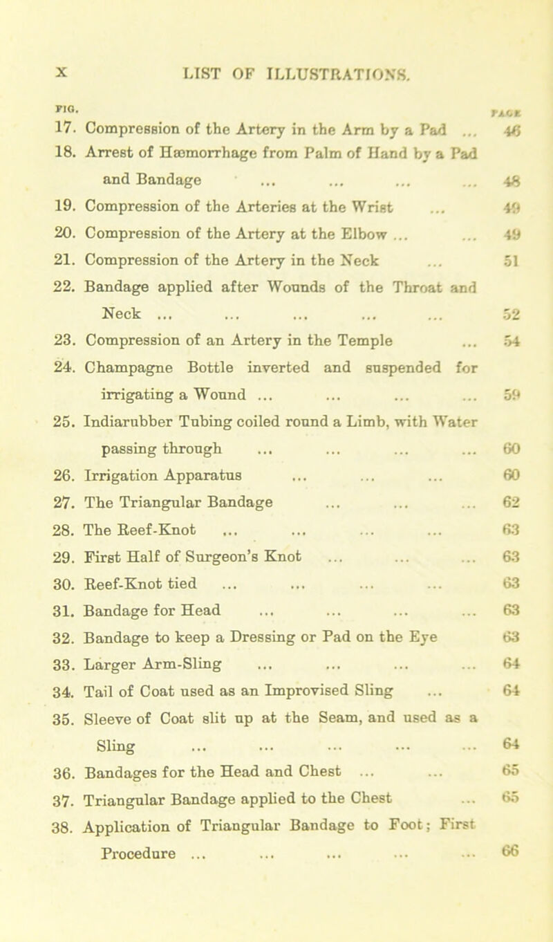 TACE 17. CompreBsion of the Artery in the Ann by a Pad ... 4^ 18. Arrest of Haemorrhage from Palm of Hand by a Pad and Bandage ... ... ... ... 19. Compression of the Arteries at the Wrist ... 49 20. Compression of the Artery at the Elbow ... ... 49 21. Compression of the Artery in the Neck ... 51 22. Bandage applied after Wonnds of the Throat and Neck ... ... ... ... ... 52 23. Compression of an Artery in the Temple ... .54 24. Champagne Bottle inverted and suspended for irrigating a Wound ... ... ... ... 59 25. Indiarubber Tubing coiled round a Limb, with IVater passing through ... ... ... ... 60 26. Irrigation Apparatus ... ... ... 60 27. The Triangular Bandage ... ... ... 62 28. The Eeef-Bjiot ... ... ... ... 63 29. First Half of Surgeon’s Knot ... ... ... 63 30. Reef-Knot tied ... ... ... ... 63 31. Bandage for Head ... ... ... ... 63 32. Bandage to keep a Dressing or Pad on the Eye 63 33. Larger Arm-Sling ... ... ... ... 64 34. Tail of Coat used as an Improvised Sling ... 64 35. Sleeve of Coat slit up at the Seam, and used as a Sling ... ... ... ... ... 64 36. Bandages for the Head and Chest ... ... 65 37. Triangular Bandage applied to the Chest ... 65 38. Application of Triangular Bandage to Foot; First Procedure ... ... ... ... ... 66