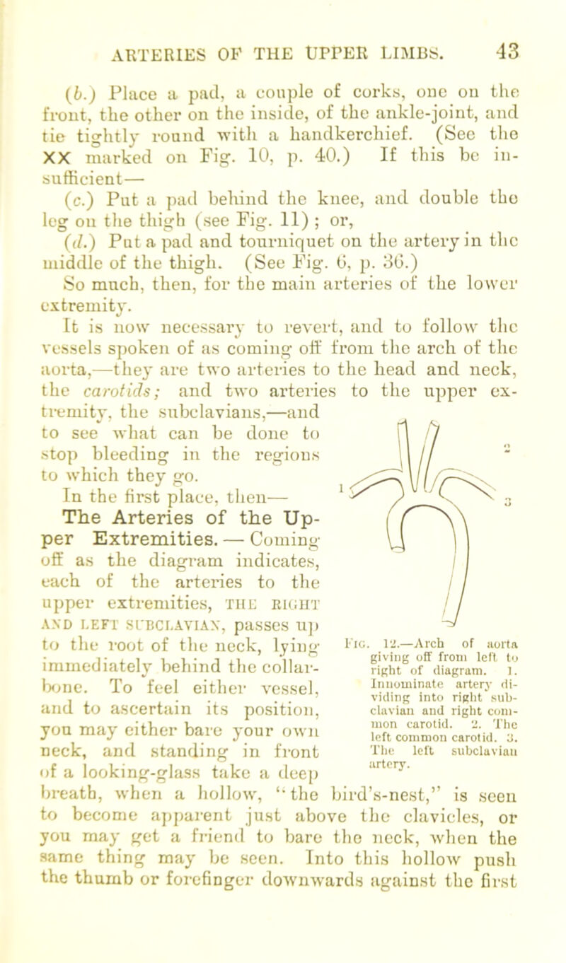 anti double tbo {b.) Place a pad, a couple of corks, one on the fi-ont, the other on the inside, of the ankle-joint, and tie tightly round with a handkerchief. (Sec the XX marked on Fig. 10, p. 40.) If this be in- sufficient— (c.) Put a patl behind the knee, leg on the thigh (see Fig. 11) ; or, ((/.) Put a pad and tourniquet on the artery in the middle of the thigh. (See Fig. 0, p. 30.) So much, then, for the main arteries of the lower extremity. It is now necessary to revert, and to follow the vessels spoken of as coming off from the arch of the aorta,—they are two arteries to the head and neck, the carotids; and two ai'teries to the upper ex- tremity, the subelavians,—and to see what can be done to stop bleeding in the regions to which they go. In the first place, then— The Arteries of the Up- per Extremities. — Coming- off as the diagram indicates, each of the arteries to the upper extremities. Tilt: eiuh'J' A.VD LEFT SL'BCI.AVIAX, paSSeS U]) to the root of the neck, lying immediately behind the collar- l»ne. To feel either vessel, and to ascertain its position, yon may either bare your own neck, and standing in front of a looking-glass take a deep breath, when a hollow, ‘-the bird’s-nest,” is seen to become apparent just above the clavicle.s, or you may get a friend to bare the neck, when the same thing may be seen. Into this hollow push the thumb or forefinger dotvuwards against the first giving off from left, to right of diagram. 1. Innominate artery di- viding into right sub- clavian and right com- mon carotid. 'J. The left common carotid. 3. The left subclavian artery.