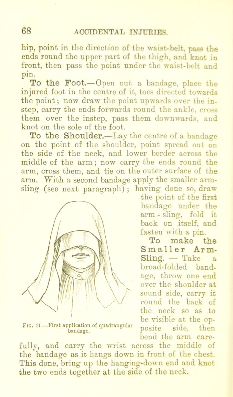 hip, point in the direction of the waist-belt, pass the ends round the upper part of the thigh, and knot in front, then pass the point under the waist-belt and pin. To the Foot.—Open out a bandage, place the injured foot in the centre of it, toes directed towards the point; now draw the point upwards over the in- step, carry the ends forwards round the ankle, cro.ss them over the instep, pass them downwards, and knot on the sole of the foot. To the Shoulder.—Lay the centre of a bandage on the point of the shoulder, point .spread out on the side of the neck, and lower border across the middle of the arm; now carry the ends round the arm, cross them, and tie on the outer surface of the arm. With a second bandage apply the smaller arm- sling (see next paragraph) ; having done so, draw the point of the first bandage under the arm - sling, fold it back on itself, and fasten with a pin. To make the Smaller Arm- Sling. — Take a broad-folded band- age, throw one end over the shoulder at sound side, carry it round the back of the neck so as to be visible at the op- FiG.41.-First«p^ica«^^^ bend the arm care- fully, and carry the wrist across the middle of the bandage as it bangs down in front of the chest. This done, bring up the hanging-down end and knot the two ends together at the side of the neck.