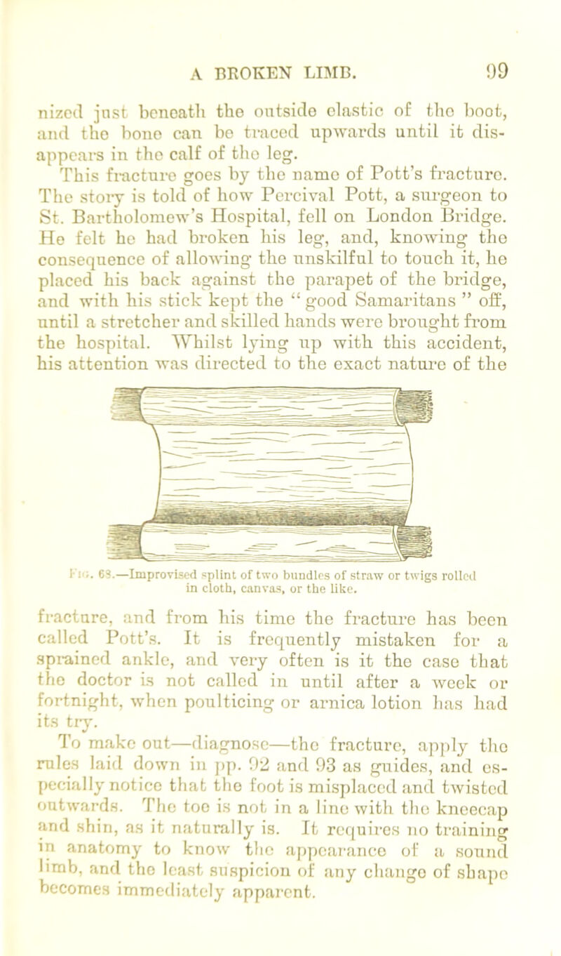 nizccl just beneath the outside clastic of the boot, and the bone can bo traced upwards until it dis- appears in the calf of the leg. This fracture goes by the name of Pott’s fracture. The story is told of how Pei’cival Pott, a surgeon to St. Bartholomew’s Hospital, fell on London Bridge. Ho felt he had broken his leg, and, knowing the consequence of allowing the unskilful to touch it, he placed his back against the parapet of the bridge, and with his stick kept the “ good Samaritans ” off, until a stretcher and skilled hands were brought from the hospital. Whilst lying iip with this accident, his attention was directed to the exact natiu’e of the Ki-;. 6S.—Improvised .splint of two bundles of straw or twigs rolled in cloth, canvas, or the like. fracture, and from his time the fracture has been called Pott’s. It is frequently mistaken for a sprained ankle, and very often is it the case that tlio doctor is not called in until after a week or fortnight, when poulticing or arnica lotion has had its tiy. To make out—diagnose—the fracture, apply the rules laid down in pp. 02 and 93 as guides, and es- pecially notice that the foot is misplaced and twisted outwards. The toe is not in a line with the kneecap and shin, as it naturally is. It requii'cs no training in anatomy to know the appearance of a sound limb, and the least suspicion of any change of shape becomes immediately apparent.