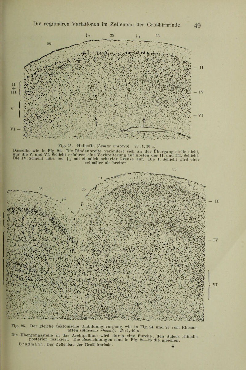 12 35 j , 36 Fig. 25. Halbafte (Lemur macaco). 25 ; 1, 10 Dasselbe wie in Fig. 24. Die Rindenbreite verändert sich an der Übergangsstelle nicht, nur die V. und VI. Schicht erfahren eine Verbreiterung auf Kosten der II. und III. Schicht. Die IV. Schicht hört bei mit ziemlich scharfer Grenze auf. Die I. Schicht wird eher schmäler als breiter. Fig. 26. Der gleiche tektonische Umbildungsvorgang wie in Fig. 24 und 25 vom Rhesus- affen (Macacus rhesiis). 25 :1, 10 /x. Die Übergangsstelle in das Archipallium wird durch eine Furche, den Sulcus rhinalis posterior, markiei’t. Die Bezeichnungen sind in Fig. 24—26 die gleichen. Brodmann, Der Zellenbau der Großhirnrinde. zj.