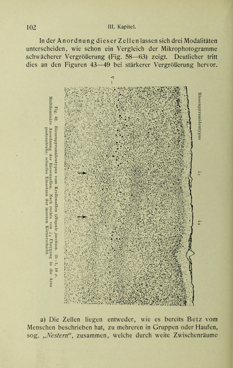 ln der Anordnung dieser Zellen lassen sich drei Modalitäten unterscheiden, wie schon ein Vergleich der Mikrophotogramme schwächerer Vergrößerung (Fig. 58—63) zeigt. Deutlicher tritt dies an den Figuren 43—49 bei stärkerer Vergrößerung hervor. <1 a) Die Zellen liegen entweder, wie es bereits Betz vom Menschen beschrieben hat, zu mehreren in Gruppen oder Haufen, sog. „Nestern“, zusammen, welche durch weite Zwischenräume