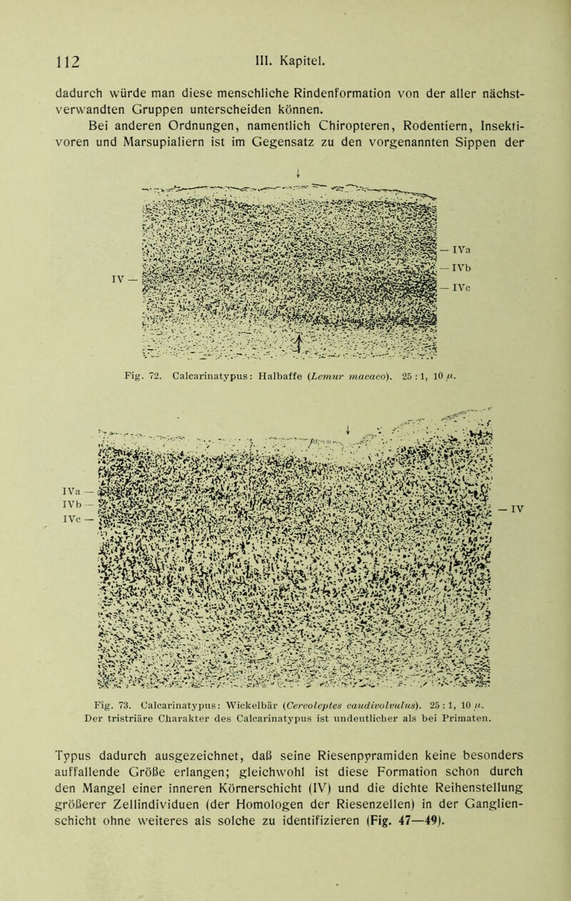 dadurch würde man diese menschliche Rindenformation von der aller nächst- verwandten Gruppen unterscheiden können. Bei anderen Ordnungen, namentlich Chiropteren, Rodentiern, Insekti- voren und Marsupialiern ist im Gegensatz zu den vorgenannten Sippen der IVa IVb IVc Fig. 72. Calcarinatypus: Halbaffe {Lemur macaeo). 25:1, 10 «. Fig. 73. Calcarinatypus: Wickelbär (Cercoleptes caudivolvulus). 25:1, 10 it. Der tristriäre Charakter des Calcarinatypus ist undeutlicher als bei Primaten. Typus dadurch ausgezeichnet, daß seine Riesenpyramiden keine besonders auffallende Größe erlangen; gleichw'Ohl ist diese Formation schon durch den Mangel einer inneren Körnerschicht (IV) und die dichte Reihenstellung größerer Zellindividuen (der Homologen der Riesenzellen) in der Ganglien- schicht ohne weiteres als solche zu identifizieren (Fig. 47—49).