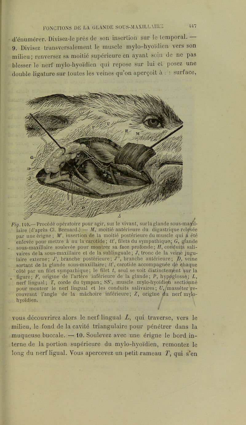 d’énumérer. Divisez-le près de son insertion sur le temporal. 9. Divisez transversalement le muscle mylo-hyoïdien vers son milieu ; renversez sa moitié supérieure en ayant soin de ne pas blesser le nerf mylo-hyoïdien qui repose sur lui et posez une double ligature sur toutes les veines qu’on aperçoit à : ; surface, Fig. 140.—Procédé opératoire pour agir, sur le vivant, surlaglande sous-maxil- laire (d’après Cl. Bernard.) — M, moitié antérieure du digastrique reliée par une érigne ; M\ insertion de la moitié postérieure du muscle qui a été enlevée pour mettre à nu la carotide; tt', filets du sympathique'; G, glande - sous-maxillaire soulevée pour montrer sa face profonde; H, conduits sali- vaires delà sous-maxillaire et de la sublinguale ; J, tronc de la veine jugu- laire externe; J', branche postérieure; J, branche antérieure; D, veine sortant de la glande sous-maxillaire; tt', carotide accompagnée de chaque côté par un filet symparhique; le filet t, seul se voit distinctement sur la figure; F, origine de l’artère inférieure de la glande; P, hypoglosse; L, nerf lingual ; P, corde du tympan; SS’, muscle mylo-hyoïdien sectionné pour montrer le nerf lingual et les conduits salivaires; U, masséter re- couvrant l’angle de la mâchoire inférieure; Z, origine du nerf mylo- hyoïdien. vous découvrirez alors le nerf lingual L, qui traverse, vers le milieu, le fond de la cavité triangulaire pour pénétrer dans la muqueuse buccale. — 10. Soulevez avec une érigne le bord in- terne de la portion supérieure du mylo-hyoïdien, remontez le long du nerf liguai. Vous apercevez un petit rameau T, qui s’en