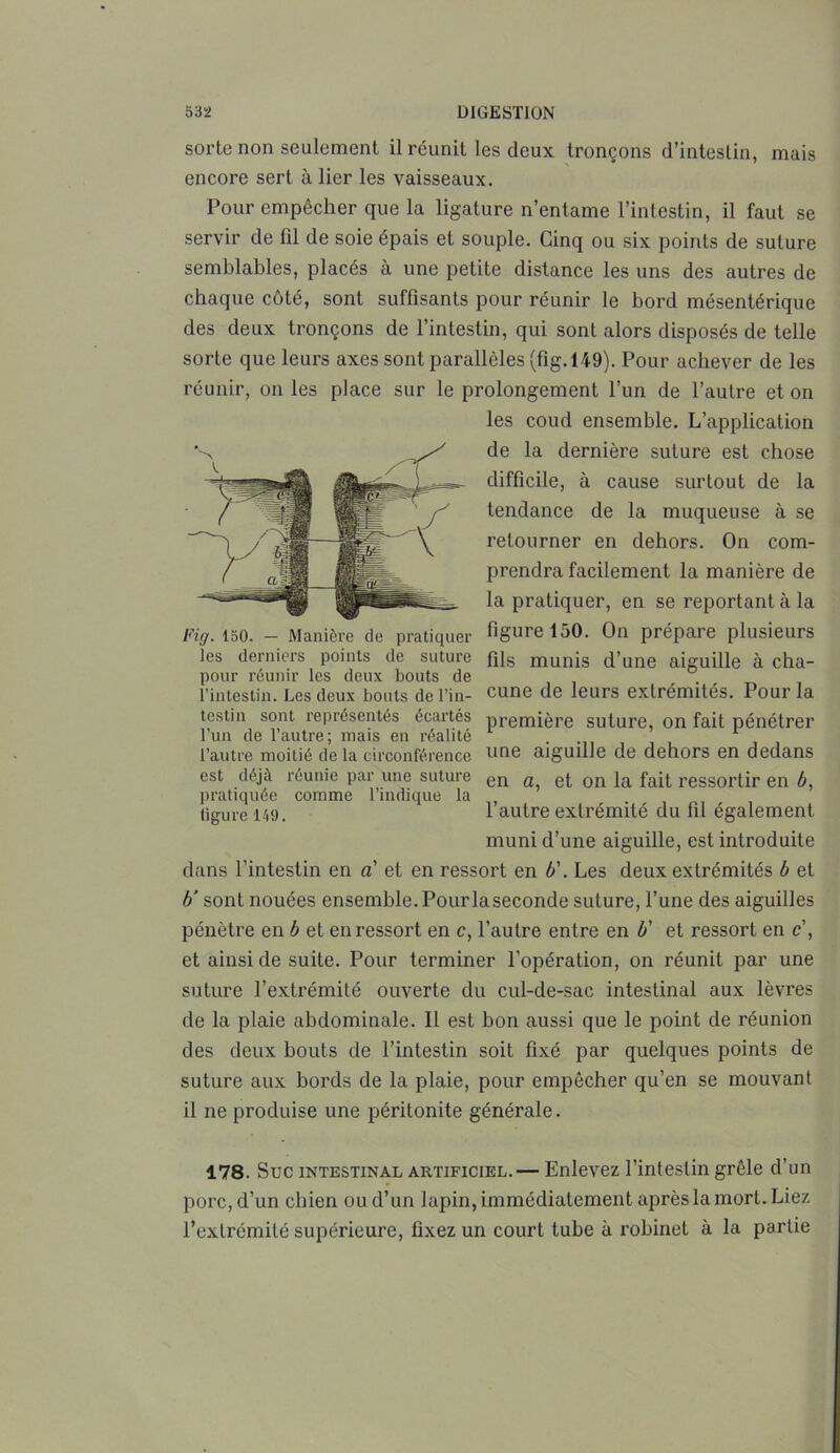 sorte non seulement il réunit les deux tronçons d’intestin, mais encore sert à lier les vaisseaux. Pour empêcher que la ligature n’entame l’intestin, il faut se servir de fil de soie épais et souple. Cinq ou six points de suture semblables, placés à une petite distance les uns des autres de chaque côté, sont suffisants pour réunir le bord mésentérique des deux tronçons de l’intestin, qui sont alors disposés de telle sorte que leurs axes sont parallèles (fig. 149). Pour achever de les réunir, on les place sur le prolongement l’un de l’autre et on les coud ensemble. L’application de la dernière suture est chose difficile, à cause surtout de la tendance de la muqueuse à se retourner en dehors. On com- prendra facilement la manière de la pratiquer, en se reportant à la figure 150. On prépare plusieurs fils munis d’une aiguille à cha- cune de leurs extrémités. Pour la première suture, on fait pénétrer une aiguille de dehors en dedans en a, et on la fait ressortir en b, l’autre extrémité du fil également muni d’une aiguille, est introduite dans l’intestin en a' et en ressort en b\ Les deux extrémités b et b' sont nouées ensemble. Pourlaseconde suture, l’une des aiguilles pénètre en b et en ressort en c, l’autre entre en b’ et ressort en c\ et ainsi de suite. Pour terminer l’opération, on réunit par une suture l’extrémité ouverte du cul-de-sac intestinal aux lèvres de la plaie abdominale. Il est bon aussi que le point de réunion des deux bouts de l’intestin soit fixé par quelques points de suture aux bords de la plaie, pour empêcher qu’en se mouvant il ne produise une péritonite générale. 178. Suc intestinal artificiel.— Enlevez l’intestin grêle d’un porc, d’un chien ou d’un lapin, immédiatement après la mort. Liez l’extrémité supérieure, fixez un court tube à robinet à la partie Fig. 150. — Manière de pratiquer les derniers points de suture pour réunir les deux bouts de l’intestin. Les deux bouts de l’in- testin sont représentés écartés l’un de l’autre; mais en réalité l’autre moitié de la circonférence est déjà réunie par une suture pratiquée comme l’indique la ligure 149.