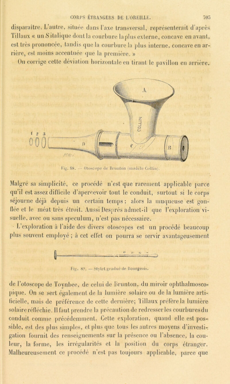 disparaître. L’autre, située dans l’axe transversal, représenterait d’après. I illaux « unSitalique dontla courbure lapins externe, concave en avant, est très prononcée, tandis que la courbure la plus interne, concave en ar- rière, est moins accentuée que la première. » Un corrige cette déviation horizontale en tirant le pavillon en arrière. Malgré sa simplicité, ce procédé n’est que rarement applicable parce qu’il est assez difficile d’apercevoir tout le conduit, surtout si le corps séjourne déjà depuis un certain temps ; alors la muqueuse est gon- llée et le méat très étroit. Aussi Després admet-il que l’exploration vi- suelle, avec ou sans spéculum, n’est pas nécessaire. • L’exploration à l’aide des divers otoscopes est un procédé beaucoup plus souvent employé ; à cet effet on pourra se servir avantageusement -1 K, l’'1TTTlri',TT Fig. <x;>. — Stylet gradué de Bourgeois. de l’otoscope de Toynbee, de celui de ürunton, du miroir ophthalmosco- pique. On se sert également de la lumière solaire ou de la lumière arti- ficielle, mais de préférence de cette dernière; liliaux préfère la lumière solaire réfléchie. Il faut prendre la précaution de redresser les courburesdu conduit comme précédemment. Cette exploration, quand elle est pos- sible, est des plus simples, et plus que tous les aut res moyens d’investi- gation fournit des renseignements sur la présence ou l’absence, la cou- leur, la forme, les irrégularités et la position du corps étranger. Malheureusement ce procédé n’est pas toujours applicable, parce que