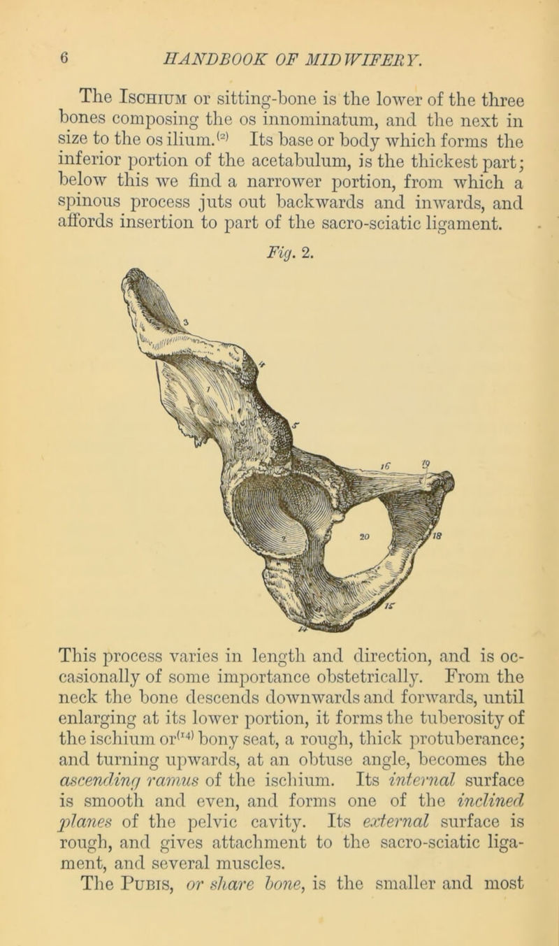 The Ischium or sitting-bone is the lower of the three bones composing the os innominatum, and the next in size to the os ilium.(2) Its base or body which forms the inferior portion of the acetabulum, is the thickest part; below this we find a narrower portion, from which a spinous process juts out backwards and inwards, and affords insertion to part of the sacro-sciatic ligament. Fig. 2. This process varies in length and direction, and is oc- casionally of some importance obstetrically. From the neck the bone descends downwards and forwards, until enlarging at its lower portion, it forms the tuberosity of the ischium or(I4) bony seat, a rough, thick protuberance; and turning upwards, at an obtuse angle, becomes the ascending ramus of the ischium. Its internal surface is smootli and even, and forms one of the inclined planes of the pelvic cavity. Its external surface is rough, and gives attachment to the sacro-sciatic liga- ment, and several muscles. The Pubis, or share hone, is the smaller and most