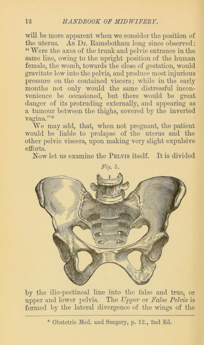 will be more apparent when we consider the position of the uterus. As Dr. Ramsbotham long since observed: “ Were the axes of the trunk and pelvic entrance in the same line, owing to the upright position of the human female, the womb, towards the close of gestation, would gravitate low into the pelvis, and produce most injurious pressure on the contained viscera; while in the early months not only would the same distressful incon- venience be occasioned, but there would be great danger of its protruding externally, and appearing as a tumour between the thighs, covered by the inverted vagina.”* We may add, that, when not pregnant, the patient would be liable to prolapse of the uterus and the other pelvic viscera, upon making very slight expulsive efforts. Now let us examine the Pelvis itself. It is divided Fig. 5. by the ilio-pectineal line into the false and true, or upper and lower pelvis. The Upper or False Pelvis is formed by the lateral divergence of the wings of the * Obstetric Med. and Surgery, p. 12., 2nd Ed.