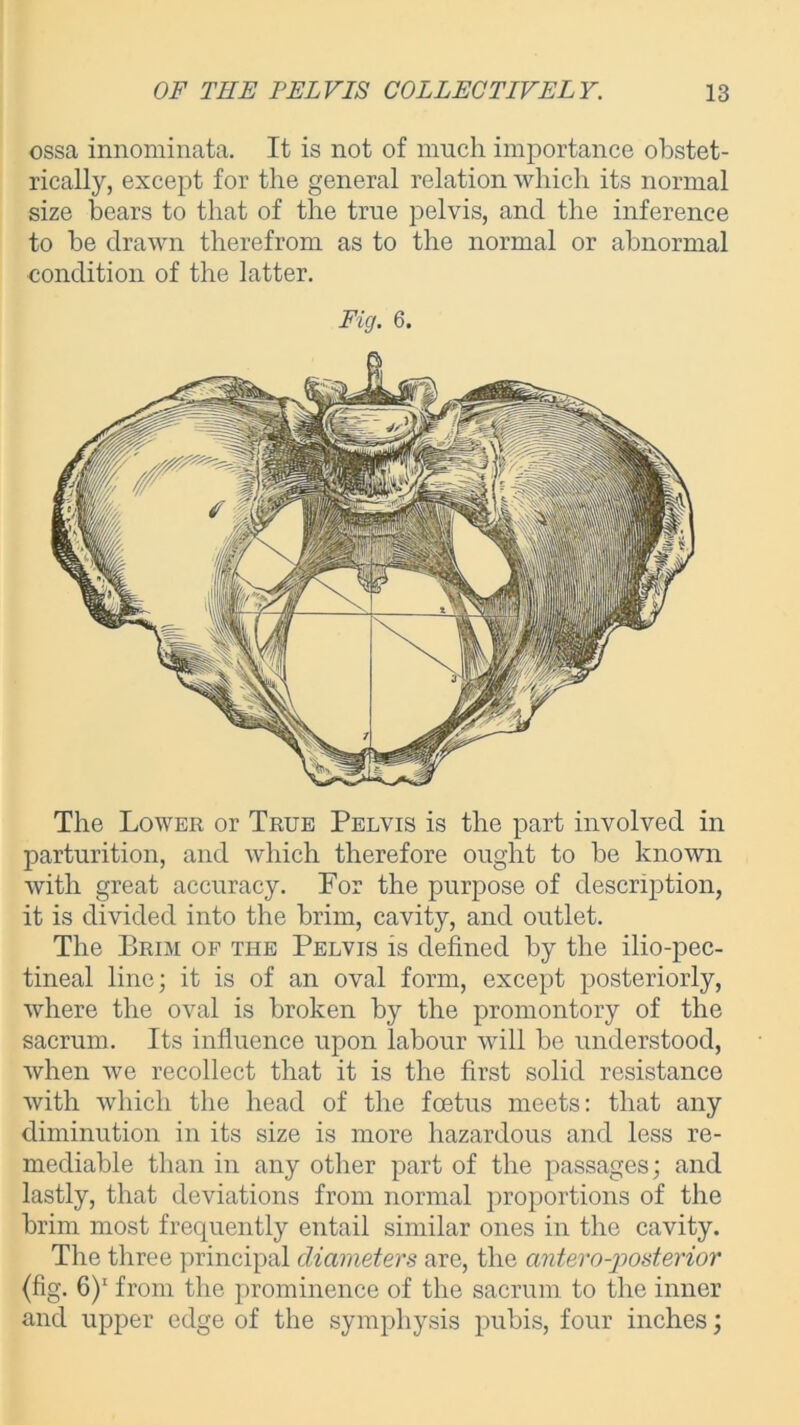 ossa innominata. It is not of much importance obstet- rically, except for the general relation which its normal size bears to that of the true pelvis, and the inference to be drawn therefrom as to the normal or abnormal condition of the latter. Fig. 6. The Lower or True Pelvis is the part involved in parturition, and which therefore ought to be known with great accuracy. For the purpose of description, it is divided into the brim, cavity, and outlet. The Brim of the Pelvis is defined by the ilio-pec- tineal line; it is of an oval form, except posteriorly, where the oval is broken by the promontory of the sacrum. Its influence upon labour will be understood, when we recollect that it is the first solid resistance with which the head of the foetus meets: that any diminution in its size is more hazardous and less re- mediable than in any other part of the passages; and lastly, that deviations from normal proportions of the brim most frequently entail similar ones in the cavity. The three principal diameters are, the anteroposterior (fig. 6)1 from the prominence of the sacrum to the inner and upper edge of the symphysis pubis, four inches;