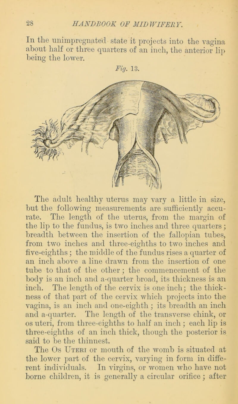 In the unimpregnated state it projects into the vagina about half or three quarters of an inch, the anterior lip being the lower. Fig. 13. The adult healthy uterus may vary a little in size, but the following measurements are sufficiently accu- rate. The length of the uterus, from the margin of the lip to the fundus, is two inches and three quarters; breadth between the insertion of the fallopian tubes, from two inches and three-eighths to two inches and five-eighths; the middle of the fundus rises a quarter of an inch above a line drawn from the insertion of one tube to that of the other; the commencement of the body is an inch and a-quarter broad, its thickness is an inch. The length of the cervix is one inch; the thick- ness of that part of the cervix which projects into the vagina, is an inch and one-eighth ; its breadth an inch and a-quarter. The length of the transverse chink, or os uteri, from three-eighths to half an inch ; each lip is three-eighths of an inch thick, though the posterior is said to be the thinnest. The Os Uteri or mouth of the womb is situated at the lower part of the cervix, varying in form in diffe- rent individuals. In virgins, or women who have not borne children, it is generally a circular orifice; after