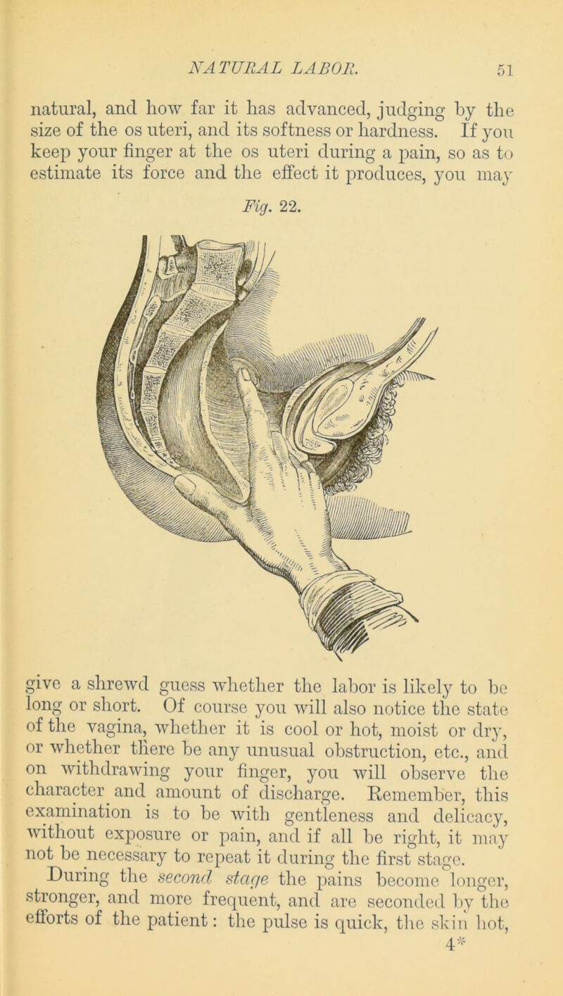 natural, and how far it has advanced, judging by the size of the os uteri, and its softness or hardness. If you keep your finger at the os uteri during a pain, so as to estimate its force and the effect it produces, you may Fig. 22. give a shrewd guess whether the labor is likely to he long or short. Of course you will also notice the state of the vagina, whether it is cool or hot, moist or dry, or whether there he any unusual obstruction, etc., and on withdrawing your finger, you will observe the character and amount of discharge. Remember, this examination is to be with gentleness and delicacy, without exposure or pain, and if all be right, it may not be necessary to repeat it during the first stage. During the second stage the pains become longer, stronger, and more frequent, and are seconded by the efforts of the patient: the pulse is quick, the skin hot, 4*