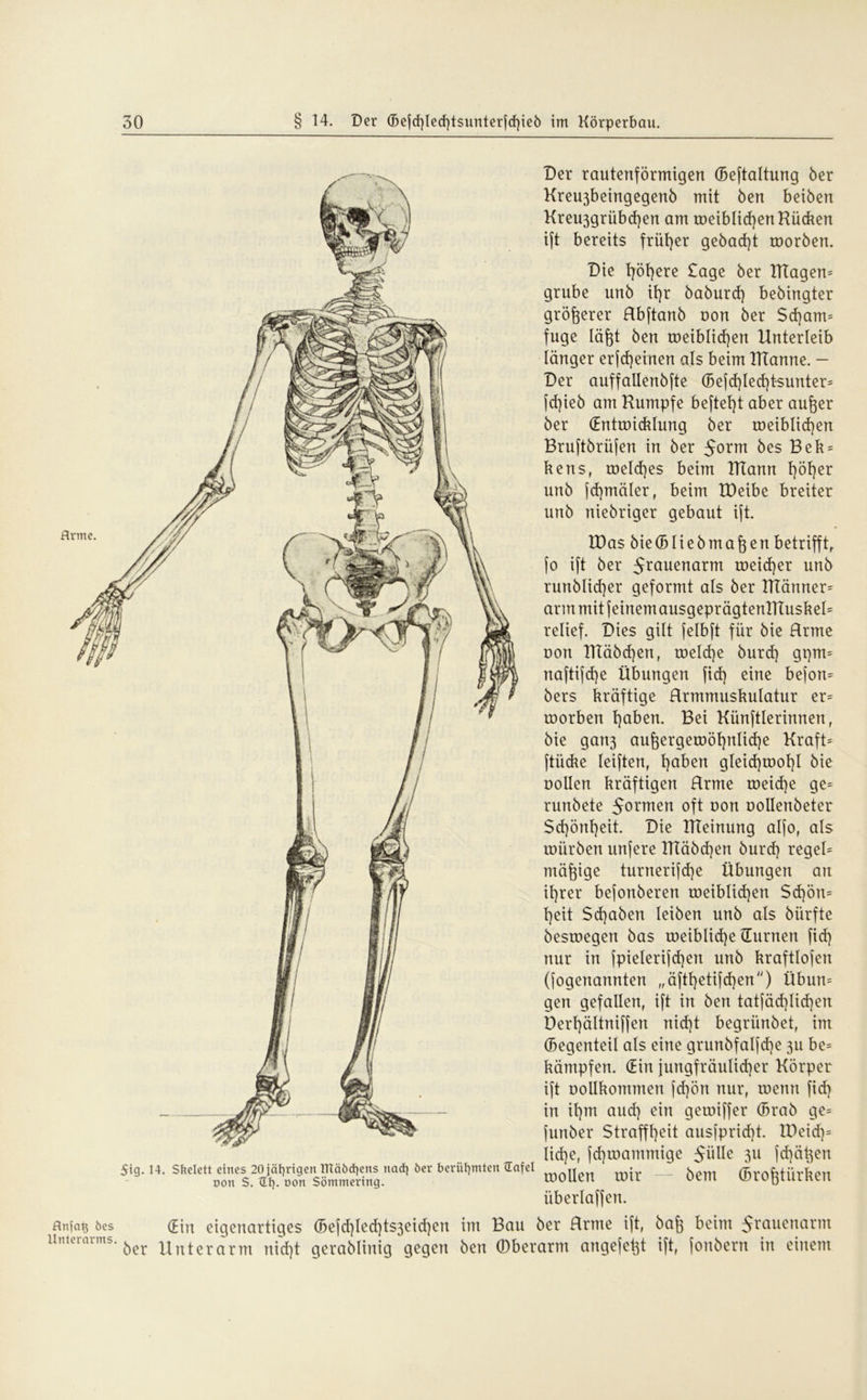 5tg. 14. Skelett eines 20 jäfyrigen mäödiens nad) 6er berühmten {Tafel oon S. dl). oon Sömmering. Der rautenförmigen (Beftaltung öer Kreujbeingegenb mit Öen beiöen Kreu3grübd)en am roeibIid)enKücken ift bereits früher gebaut roorben. Die t)öt)ere Sage ber Klägern grübe unb it}r baburd) bebingter größerer Rbftanb non ber $d)am= fuge läßt ben meiblidjen Unterleib länger erfdjeinen als beim ITTanne. - Der auffallenbfte (Befd)led)t-sunter= [d)ieb am Kumpfe beftet)t aber außer ber (Entwicklung ber weiblichen Bruftbrüfen in ber $oxm bes Bek = kens, welches beim TtTann t)öt)er unb fd)mäler, beim IDeibe breiter unb niebriger gebaut ift. löas bie(BIiebmaßen betrifft, [o ift ber 5rauenörm weicher unb runblid)er geformt als ber ITtänner^ arm mit feinem ausgeprägtenlftuskeH relief. Dies gilt felbft für bie Rrme non Kläbdjen, welche burd) gpm* naftifd}e Übungen fid) eine befon* bers kräftige Rrmmuskulatur er= roorben t]aben. Bei Händlerinnen, bie gan3 außergewöhnliche Kraft= ftiicke leiften, l)aben gleid)mot)l bie Dollen kräftigen Rrme weiche ge= runbete 5ormen oft oon oollenbeter $d)önl)eit. Die Hteinung alfo, als mürben unfere KTäbd)en burd} regel- mäßige turnerifd)e Übungen an ihrer befonberen weiblichen $d)ön= l}eit $d)aben leiben unb als bürfte besroegen bas roeiblid}e (Turnen fid) nur in jpielerifd}en unb kraftlofen (fogenannten „äftfjetifdjen) Übun= gen gefallen, ift in ben tatfäd}Iid}en Derßältniffen nid}t begriinbet, im (Begenteil als eine grunbfalfd)e 31t be= kämpfen. (Ein jungfräulicher Körper ift Dollkommen fd)ön nur, roenn fid] in il}m aud] ein geroiffer (Brab ge= funöer Straffheit ausfprid}t. rDei'd}= liehe, fd)toammige $\\IU 311 fdjäßen roollen roir — bem (Broßtürken überlaffen. anfas 6es (Ein eigenartiges (Befd)Ied)ts3eid}en im Bau ber Rrme ift, baß beim 5raKenarm iintei ^er Unterarm nicht gerablinig gegen ben ©berarm angefeßt ift, fonbern in einem