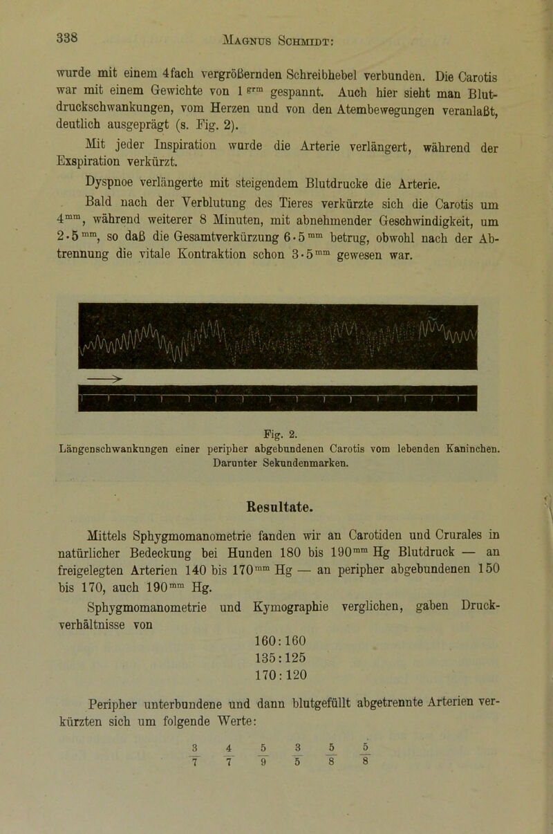 wurde mit einem 4fach vergrößernden Schreibhebel verbunden. Die Carotis war mit einem Gewichte von 1 e™ gespannt. Auch hier sieht man Blut- druckschwankungen, vom Herzen uud von den Atembewegungen veranlaßt, deutlich ausgeprägt (s. Fig. 2). Mit jeder Inspiration wurde die Arterie verlängert, während der Exspiration verkürzt. Dyspnoe verlängerte mit steigendem Blutdrucke die Arterie. Bald nach der Verblutung des Tieres verkürzte sich die Carotis um 4mm, während weiterer 8 Minuten, mit abnehmender Geschwindigkeit, um 2 • 5 mm, so daß die Gesamtverkürzung 6 • 5 ram betrug, obwohl nach der Ab- trennung die vitale Kontraktion schon 3-5mm gewesen war. Fig. 2. Längen Schwankungen einer peripher abgebundenen Carotis vom lebenden Kaninchen. Darunter Sekundenmarken. Resultate. Mittels Sphygmomanometrie fanden wir an Carotiden und Crurales in natürlicher Bedeckung bei Hunden 180 bis 190mm Hg Blutdruck — an freigelegten Arterien 140 bis 170mm Hg — an peripher abgebundenen 150 bis 170, auch 190mra Hg. Sphygmomanometrie und Kymographie verglichen, gaben Druck- verhältnisse von 160:160 135:125 170:120 Peripher unterbundene und dann blutgefüllt abgetrennte Arterien ver- kürzten sich um folgende Werte: 3 4 5 3 _5 _5 T T IT 5 8 8