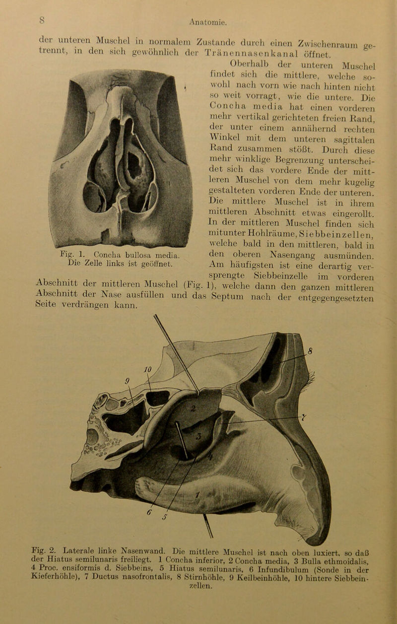 Fig. 2. Laterale linke Nasenwand. Die mittlere Muschel ist nach oben luxiert, so daß der Hiatus semilunaris freiliegt. 1 Concha inferior, 2 Concha media, 3 Bulla ethmoidalis, 4 Proc. ensiformis d. Siebbeins, 5 Hiatus semilunaris, 6 Infundibulum (Sonde in der Kieferhöhle), 7 Ductus nasofrontalis, 8 Stirnhöhle, 9 Keilbeinhöhle, 10 hintere Siebbein- /ellen. Anatomie. dcj- unteren Musdiel in nonnaleni Zustande durch einen Zwischenraum ge- trennt, in den sieli gcwühnlich der Tränennasenkanal öffnet. Oberhalb der unteren Muschel findet sich die mittlere, welche so- wohl nach voim wie nach hinten nicht so weit vorragt, wie die untere. Die Concha media hat einen vorderen mehr vertikal gerichteten freien Rand, der unter einem annähernd rechten Winkel mit dem unteren sagittalen Rand zusammen stößt. Durch diese mehr winklige Begrenzung unterschei- det sich das vordere Ende der mitt- leren Muschel von dem mehr kugelig gestalteten vorderen Ende der unteren. Die mittlere Muschel ist in ihrem mittleren Abschnitt etwas eingerollt. In der mittleren Muschel finden sich mitunter Hohlräume, Siebbeinzellen, welche bald in den mittleren, bald in den oberen Nasengang ausmünden. Am häufigsten ist eine derartig ver- sprengte Siebbeinzelle im vorderen AbschnRt der mittleren Muschel (Fig. 1), welche dann den ganzen mittleren Abschnitt der Nase ausfüllen und das Septum nach der entgegengesetzten Seite verdrängen kann. Fig.^ 1. Concha bullosa media. Die Zelle links ist geöffnet.