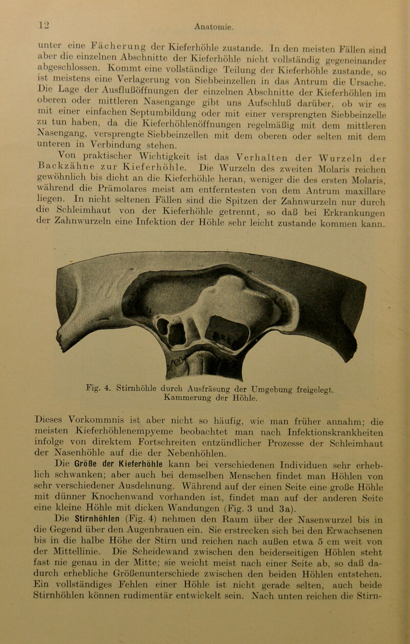 unter eine luicheruiig der Kieferliöhle zustande, ln den meisten Fällen sind abei die einzelnen Abschnitte der Kieferhöhle nicht vollständig gegeneinander abgeschlossen. Kommt eine vollständige Teilung der Kieferhöhle zustande, so ist meistens eine Verlagerung von Sielibeinzellen in das Antimm die Ursache. Die Lage der Ausflußöffnungen der einzelnen Abschnitte der Kieferhöhlen im oberen oder mittleren Nasengange gibt uns Aufschluß darüber, ob wir es mit einer einfachen Septumbildung oder mit einer versprengten Siebbeinzelle zu tun haben, da die Kieferhöhlenöffnungen regelmäßig mit dem mittleren Nasengang, versprengte Siebbeinzellen mit dem oberen oder selten mit dem unteren in Verbindung stehen. Von praktischer Wichtigkeit ist das Verhalten der Wurzeln der Backzähne zur Kieferhöhle. Die Wurzeln des zweiten Molaris reichen gewöhnlich bis dicht an die Kieferhöhle heran, weniger die des ersten Molaris, V ährend die Prämolares meist am entferntesten von dem Antrum maxillare liegen. In nicht seltenen Fällen sind die Spitzen der Zahnwurzeln nur durch die Schleimhaut von der Kieferhöhle getrennt, so daß bei Erkrankungen der Zahnv urzeln eine Infektion der Höhle sehr leicht zustande kommen kann. Fig. 4. Stirnhöhle durch Ausfräsung der Umgebung freigelegt. Kammerung der Höhle. Dieses Vorkommnis ist aber nicht so häufig, wie man früher annahm; die meisten Kieferhöhlenempyeme beobachtet man nach Infektionskrankheiten infolge von direktem Fortschreiten entzündlicher Prozesse der Schleimhaut der Nasenhöhle auf die der Nebenhöhlen. Die Größe der Kieferhöhle kann bei verschiedenen Individuen sehr erheb- lich schwanken; aber auch bei demselben Menschen findet man Höhlen von sehr verschiedener Ausdehnung. Während auf der einen Seite eine große Höhle mit dünner Knochen wand vorhanden ist, findet man auf der anderen Seite eine kleine Höhle mit dicken Wandungen (Fig. 3 und 3 a). Die Stirnhöhlen (Fig. 4) nehmen den Raum über der Nasenwurzel bis in die Gegend über den Augenbrauen ein. Sie erstrecken sich bei den Erwachsenen bis in die halbe Höhe der Stirn und reichen nach außen etwa 5 cm weit von der Mittellinie. Die Scheidewand zwischen den beiderseitigen Höhlen steht fast nie genau in der Mitte; sie weicht meist nach einer Seite ab, so daß da- durch erhebliche Größenunterschiede zwischen den beiden Höhlen entstehen. Ein vollständiges Fehlen einer Höhle ist nicht gerade selten, auch beide Stirnhöhlen können rudimentär entwickelt sein. Nach unten reichen die Stirn-