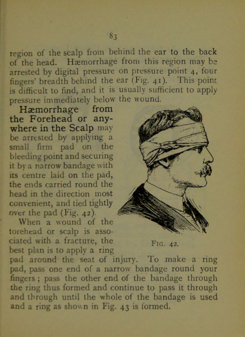 region of the scalp from behind the ear to the back of the head. Haemorrhage from this region may be arrested by digital pressure on pressure point 4, four fingers’ breadth behind the ear (Fig. 41). This point is difficult to find, and it is usually sufficient to apply pressure immediately below the wound. Haemorrhage from the Forehead or any- where in the Scalp may be arrested by applying a small firm pad on the bleeding point and securing it by a narrow bandage with its centre laid on the pad, the ends carried round the head in the direction most convenient, and tied tightly over the pad (Fig. 42). When a wound of the torehead or scalp is asso- ciated with a fracture, the best plan is to apply a ring pad around the seat of injury. To make a ring pad, pass one end of a narrow bandage round your fingers; pass the other end of the bandage through the ring thus formed and continue to pass it through and through until the whole of the bandage is used