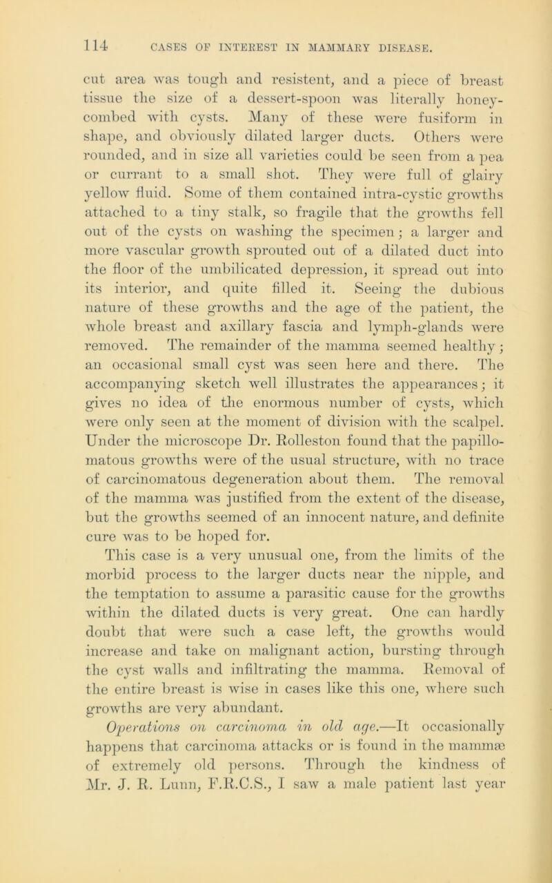 cut area was tough and resistent, and a piece of breast tissue the size of a dessert-spoon was literally honey- combed with cysts. Many of these were fusiform in shape, and obviously dilated larger ducts. Others were rounded, and in size all varieties could be seen from a pea or currant to a small shot. They were full of glairy yellow fluid. Some of them contained intra-cystic growths attached to a tiny stalk, so fragile that the growths fell out of the cysts on washing the specimen; a larger and more vascular growth sprouted out of a dilated duct into the floor of the umbilicated depression, it spread out into its interior, and quite filled it. Seeing the dubious nature of these growths and the age of the patient, the whole breast and axillary fascia and lymph-glands were removed. The remainder of the mamma seemed healthy; an occasional small cyst was seen here and there. The accompanying sketch well illustrates the appearances; it gives no idea of the enormous number of cysts, which were only seen at the moment of division with the scalpel. Under the microscope Dr. Rolleston found that the papillo- matous growths were of the usual structure, with no trace of carcinomatous degeneration about them. The removal of the mamma was justified from the extent of the disease, but the growths seemed of an innocent nature, and definite cure was to be hoped for. This case is a very unusual one, from the limits of the morbid process to the larger ducts near the nipple, and the temptation to assume a parasitic cause for the growths within the dilated ducts is very great. One can hardly doubt that were such a case left, the growths would increase and take on malignant action, bursting through the cyst walls and infiltrating the mamma. Removal of the entire breast is wise in cases like this one, where such growths are very abundant. Operations on carcinoma in old age.—It occasionally happens that carcinoma attacks or is found in the mammae of extremely old persons. Through the kindness of Mr. J. R. Lunn, F.R.C.S., I saw a male patient last year