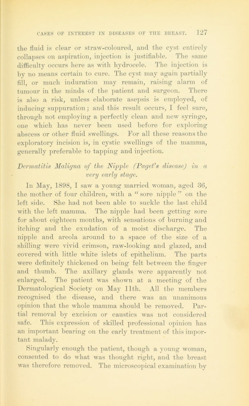 the thud is clear or straw-coloured, and the cyst entirely collapses on aspiration, injection is justifiable. The same difficulty occurs here as with hydrocele. The injection is by no means certain to cure. The cyst may again partially fill, or much induration may remain, raising alarm of tumour in the minds of the patient and surgeon. There is also a risk, unless elaborate asepsis is employed, of inducing suppuration; and this result occurs, I feel sure, through not employing a perfectly clean and new syringe, one which has never been used before for exploring abscess or other fluid swellings. For all these reasons the exploratory incision is, in cystic swellings of the mamma, generally preferable to tapping and injection. Dermatitis Maligna of the Nipple (Paget’s disease) in a very early stage. In May, 1898, I saw a young married woman, aged 36, the mother of four children, with a “ sore nipple ” on the left side. She had not been able to suckle the last child with the left mamma. The nipple had been getting sore for about eighteen months, with sensations of burning and itching’ and the exudation of a moist discharge. The nipple and areola around to a space of the size of a shilling were vivid crimson, raw-looking and glazed, and covered with little white islets of epithelium. The parts were definitely thickened on being felt between the finger and thumb. The axillary glands were apparently not enlarged. The patient was shown at a meeting of the Dermatological Society on May lltli. All the members recognised the disease, and there was an unanimous opinion that the whole mamma should be removed. Par- tial removal by excision or caustics was not considered safe. This expression of skilled professional opinion has an important bearing on the early treatment of this impor- tant malady. Singularly enough the patient, though a young woman, consented to do what was thought right, and the breast was therefore removed. The microscopical examination by