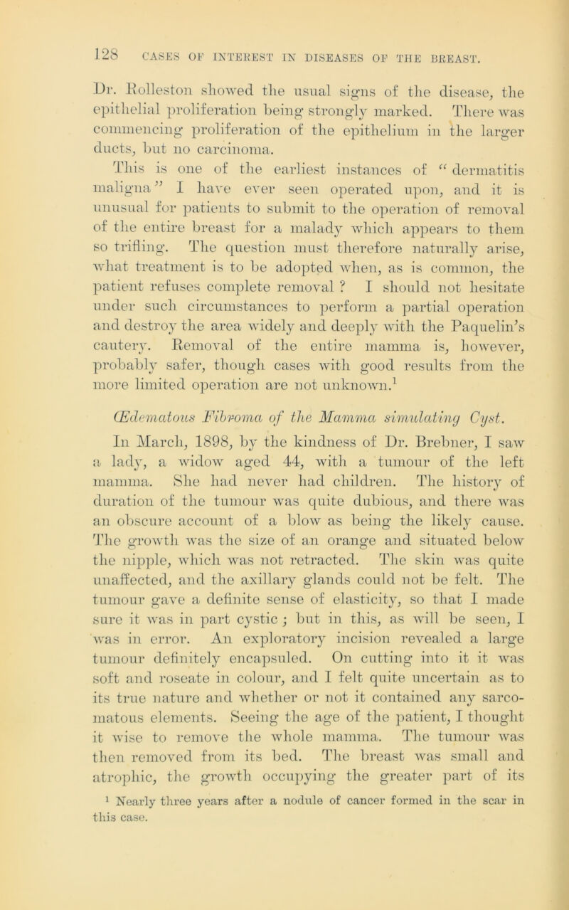Dr. Rolleston showed tlie usual signs of the disease, the epithelial proliferation being strongly marked. There was commencing proliferation of the epithelium in the larger ducts, but no carcinoma. This is one of the earliest instances of “ dermatitis maligna ” I have ever seen operated upon, and it is unusual for patients to submit to the operation of removal of the entire breast for a malady which appears to them so trifling. The question must therefore naturally arise, what treatment is to be adopted when, as is common, the patient refuses complete removal ? I should not hesitate under such circumstances to perform a partial operation and destroy the area widely and deeply with the Paqueliids cautery. Removal of the entire mamma is, however, probably safer, though cases with good results from the more limited operation are not unknown.1 (Edematous Fibroma of the Mamma simulating Cyst. In March, 1898, by the kindness of Dr. Brebner, I saw a lady, a widow aged 44, with a tumour of the left mamma. She had never had children. The history of duration of the tumour was quite dubious, and there was an obscure account of a blow as being the likely cause. The growth was the size of an orange and situated below the nipple, which was not retracted. The skin was quite unaffected, and the axillary glands could not be felt. The tumour gave a definite sense of elasticity, so that I made sure it was in part cystic ; but in this, as will be seen, I was in error. An exploratory incision revealed a large tumour definitely encapsuled. On cutting into it it was soft and roseate in colour, and I felt quite uncertain as to its true nature and whether or not it contained any sarco- matous elements. Seeing the age of the patient, I thought it wise to remove the whole mamma. The tumour was then removed from its bed. The breast was small and atrophic, the growth occupying the greater part of its 1 Nearly three years after a nodule of cancer formed in tlie scar in this case.