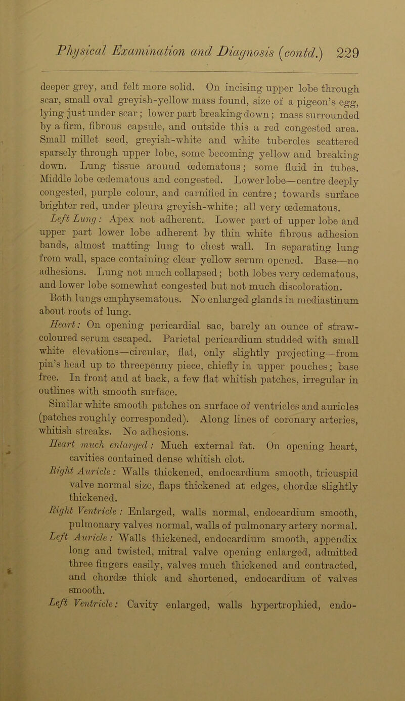 deeper grey, and felt more solid. On incising upper lobe through scar, small oval greyish-yellow mass found, size of a pigeon’s egg, lyiiig just under scar; lower part breaking down; mass surrounded by a firm, fibrous capsule, and outside this a red congested area. Small millet seed, greyish-white and white tubercles scattered sparsely through upper lobe, some becoming yellow and breaking down. Lung tissue around oedematous; some fluid in tubes. Middle lobe oedematous and congested. Lower lobe—centre deeply congested, purple colour, and carnified in centre; towards surface brighter red, under pleui’a greyish-white; all very oedematous. Left Lung: Apex not adherent. Lower part of upper lobe and upper part lower lobe adherent by thin white fibrous adhesion bands, almost matting lung to chest wall. In separating lung from wall, space containing clear yellow serum opened. Base—no adhesions. Lung not much collapsed; both lobes very oedematous, and lower lobe somewhat congested but not much discoloration. Both lungs emphysematous. No enlarged glands in mediastinum about roots of luns:. Heart: On opening pericardial sac, barely an ounce of straw- coloured serum escaped. Parietal pericardium studded with small white elevations—circular, flat, only slightly projecting—from pin’s head up to threeiienny piece, chiefly in ui^per pouches; base free. In front and at back, a few flat whitish patches, irregular in outlines with smooth surface. Similar white smooth patches on surface of ventricles and auricles (patches roughly corresponded). Along lines of coronary arteries, whitish streaks. No adhesions. Heart much enlarged: Much external fat. On opening heart, cavities contained dense whitish clot. Right Auricle : Walls thickened, endocardium smooth, tricuspid valve normal size, flaps thickened at edges, chordae slightly thickened. Right Ventricle : Enlarged, walls normal, endocardium smooth, pulmonary valves normal, walls of pulmonary artery normal. Left Auricle: Walls thickened, endocardium smooth, apjDendix long and twisted, mitral valve opening enlarged, admitted three fingers easily, valves much thickened and contracted, and chordae thick and shortened, endocardium of valves smooth. Left Ventricle: Cavity enlarged, walls hypertrophied, endo-