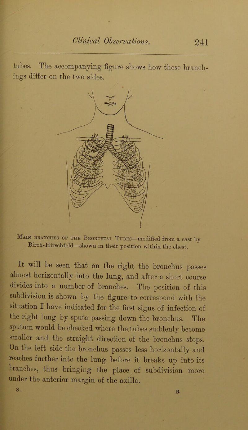 tubes. The accompanying figure shows how these brandl- ings differ on the two sides. Main beanches of the Beonchial Tubes—modified from a cast by Bircli-Hirschfeld—shown in their position within the chest. It will be seen that on the right the bronchus passes almost horizontally into the lung, and after a short course divides into a number of branches. The position of this subdivision is shown by the figure to correspond with the situation I have indicated for the first signs of infection of the right lung by sputa passing down the bronchus. The sputum would bo checked where the. tubes suddenly become smaller and the straight direction of the bronchus stops. On the left side the bronchus passes less horizontally and reaches further into the lung before it breaks uj^ into its branches, thus bringing the place of subdivision more under the anterior margin of the axilla.