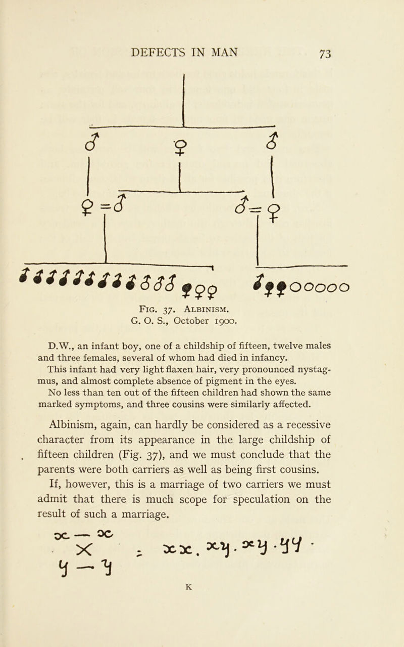 3 9 $ £££££££$$$$$ £ ffooooo D.W., an infant boy, one of a childship of fifteen, twelve males and three females, several of whom had died in infancy. This infant had very light flaxen hair, very pronounced nystag- mus, and almost complete absence of pigment in the eyes. No less than ten out of the fifteen children had shown the same marked symptoms, and three cousins were similarly affected. Albinism, again, can hardly be considered as a recessive character from its appearance in the large childship of fifteen children (Fig. 37), and we must conclude that the parents were both carriers as well as being first cousins. If, however, this is a marriage of two carriers we must admit that there is much scope for speculation on the result of such a marriage. Fig. 37. Albinism. G. O. S., October 1900. K