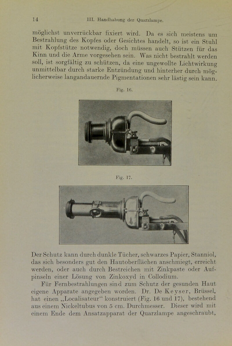 möglichst unverrückbar fixiert wird. Da es sich meistens um Bestrahlung des Kopfes oder Gesichtes handelt, so ist ein Stuhl mit Kopfstütze notwendig, doch müssen auch Stützen für das Kinn und die Arme vorgesehen sein. Was nicht bestrahlt werden soll, ist sorgfältig zu schützen, da eine ungewollte Lichtwirkung unmittelbar durch starke Entzündung und hinterher durch mög- licherweise langandauernde Pigmentationen sehr lästig sein kann. Fig. 16. Fig. 17. Der Schutz kann durch dunkle Tücher, schwarzes Papier, Stanniol, das sich besonders gut den Hautoberflächen anschmiegt, erreicht werden, oder auch durch Bestreichen mit Zinkpaste oder Auf- pinseln einer Lösung von Zinkoxyd in Collodium. Für Fernbestrahlungen sind zum Schutz der gesunden Haut eigene Apparate angegeben worden. Dr. De Iveyser, Brüssel, hat einen „Localisateur“ konstruiert (Fig. 16 und 17), bestehend aus einem Nickeltubus von 5 cm. Durchmesser. Dieser wird mit einem Ende dem Ansatzapparat der Quarzlampe angeschraubt,