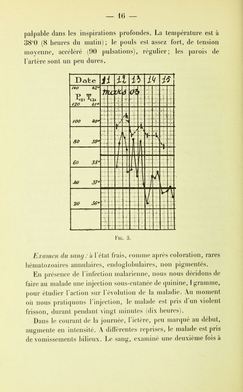 palpable dans les inspirations profondes. La température est à 38°0 (8 heures du matin) ; le pouls est assez fort, de tension moyenne, accéléré (90 pulsations), régulier; les parois de l’artère sont un peu dures. Date a il ib lit. i* /UO 42° P T x<2> 420 0/0 m M j-; ‘i <k> L* -4 • U 400 40* :p4 k t: ^ S -L. fi ; 4' 1 r T' SO 39* “‘î'T T k ! i | 4* • 60 38* I : Il 1 4: i l r ■ j\ ■ *0 37* • i _:.,i — 1 t % 20 36* i VL. -j-: i. ...... .. : j • *• •i Fig. 3. Examen du sang : à l’état frais, comme après coloration, rares hématozoaires annulaires, endoglobulaires, non pigmentés. En présence de l’infection malarienne, nous nous décidons de faire au malade une injection sous-cutanée de quinine, 1 gramme, pour étudier l’action sur l’évolution de la maladie. Au moment où nous pratiquons l’injection, le malade est pris d un violent frisson, durant pendant vingt minutes (dix heures). Dans le courant de la journée, l’ictère, peu marqué au début, augmente en intensité. A différentes reprises, le malade est pris de vomissements bilieux. Le sang, examiné une deuxième fois à
